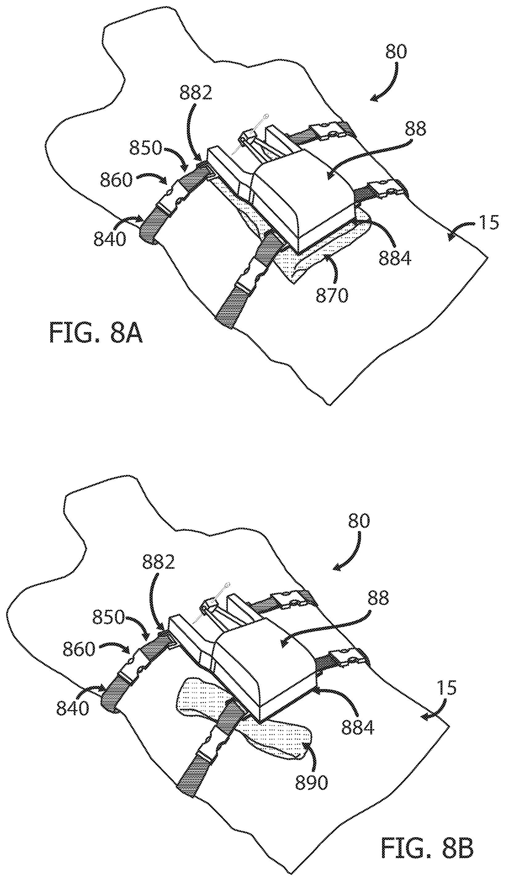 Patent US12551233 Figure 8 – Devices and methods for attaching a medical device to a subject