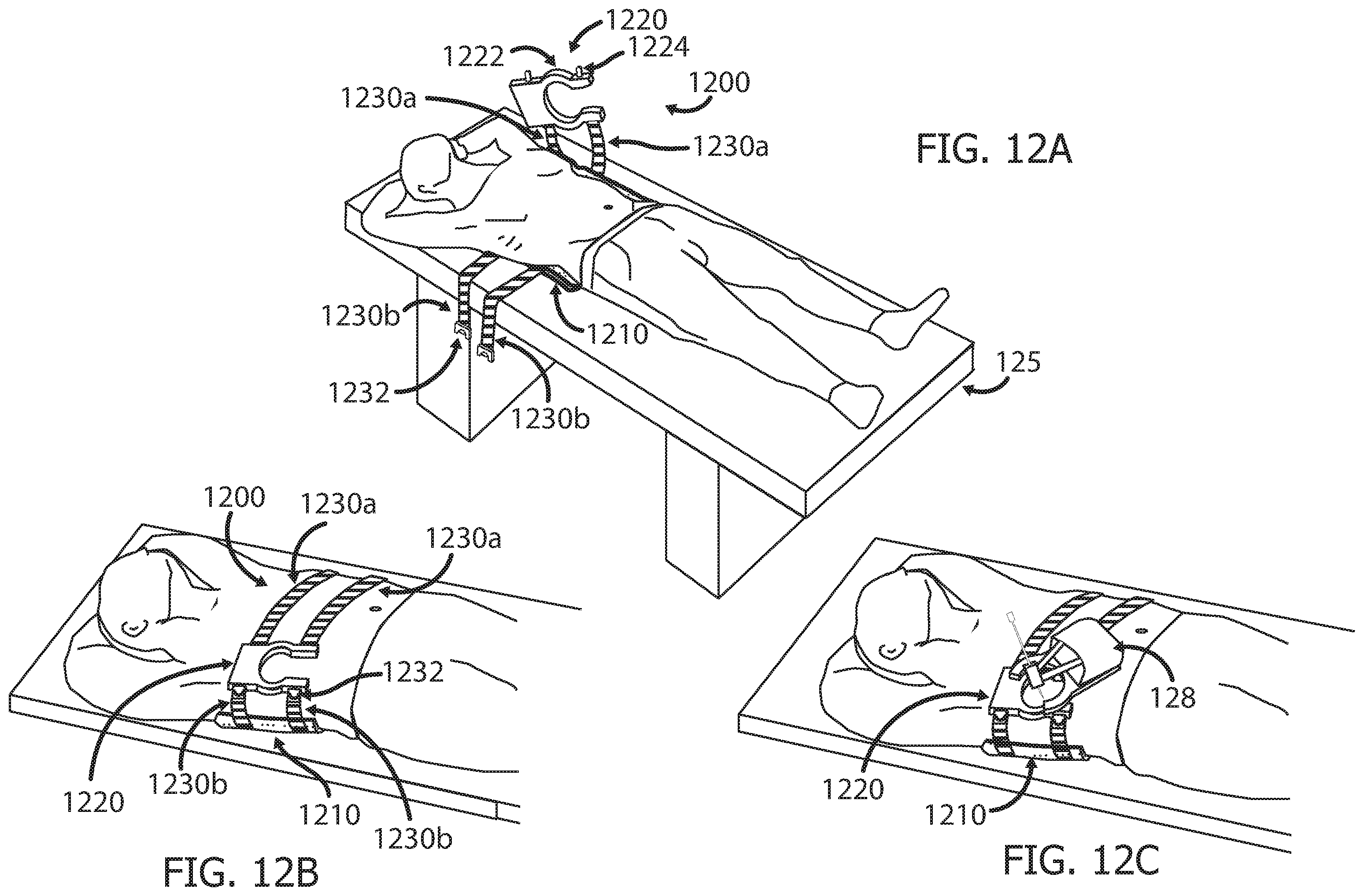 Patent US12551233 Figure 13 – Devices and methods for attaching a medical device to a subject