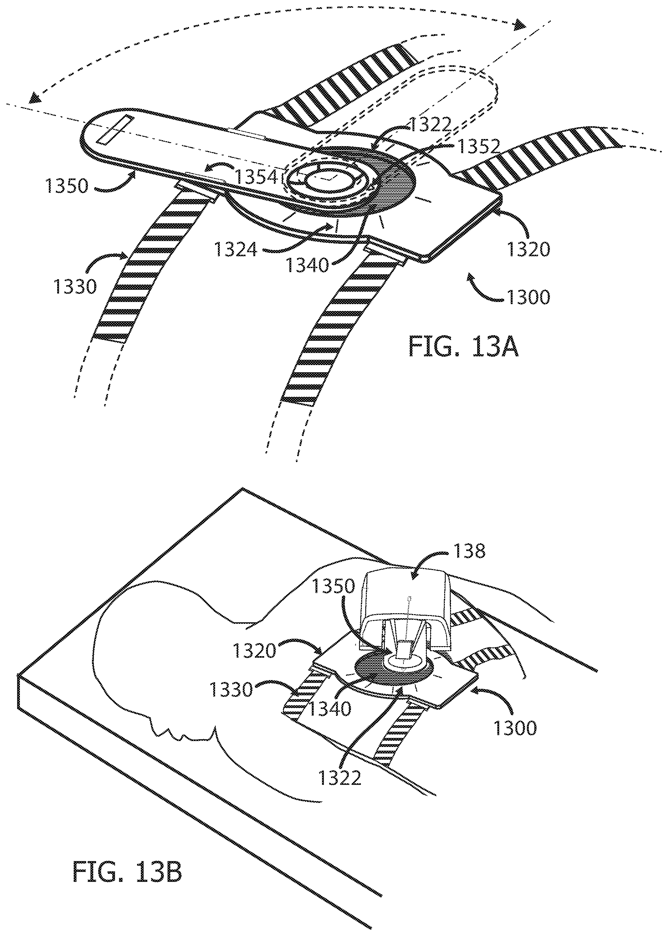 Patent US12551233 Figure 14 – Devices and methods for attaching a medical device to a subject