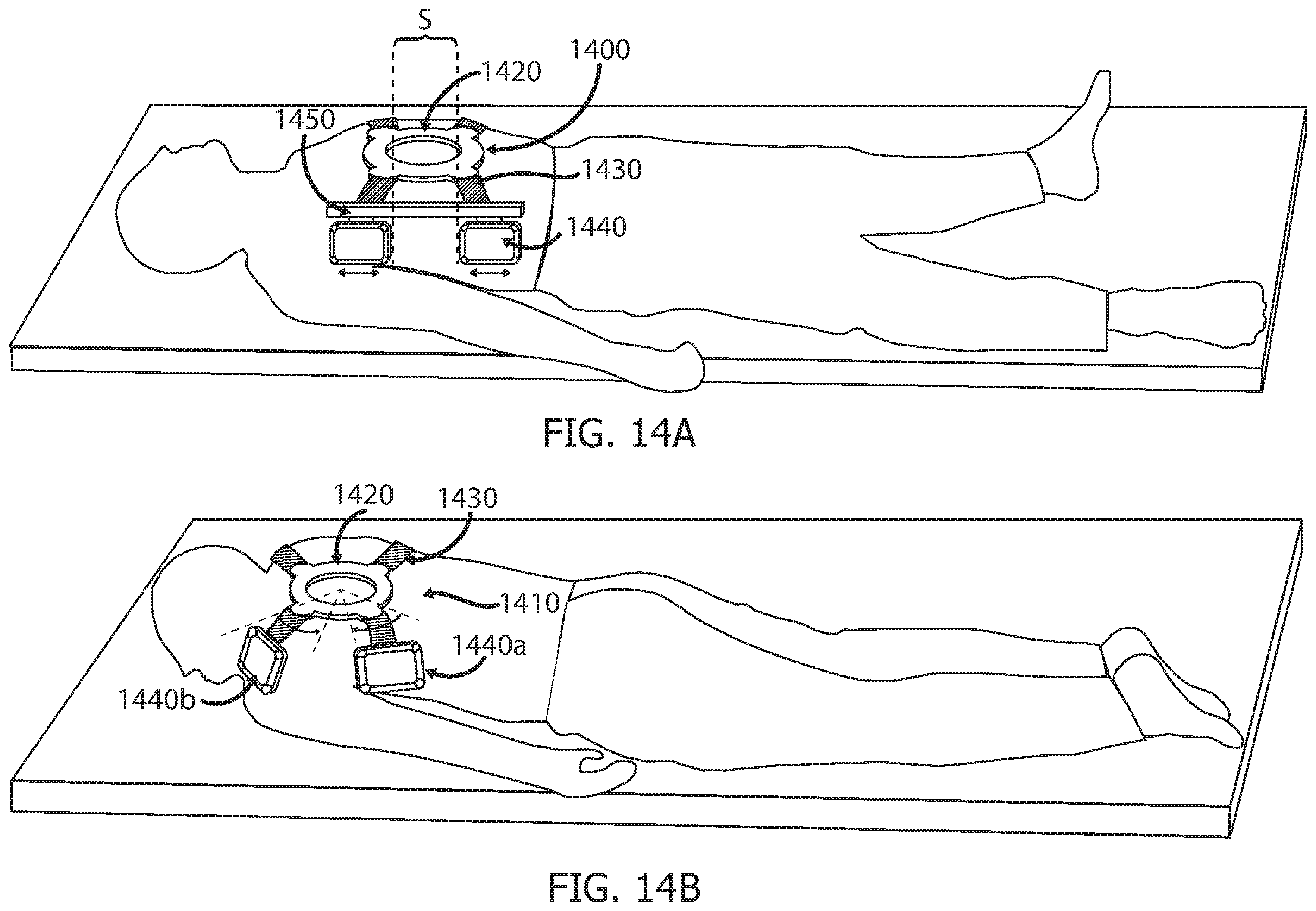 Patent US12551233 Figure 15 – Devices and methods for attaching a medical device to a subject