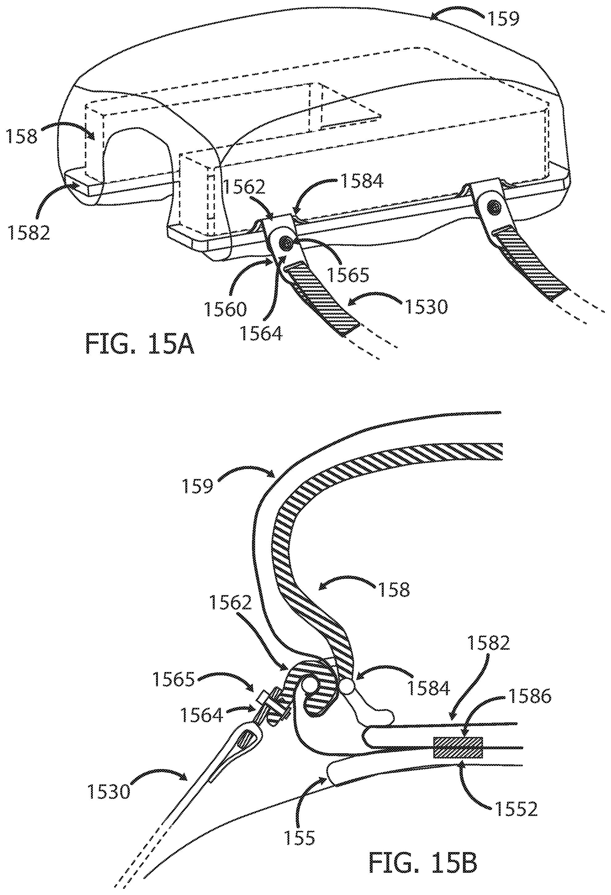 Patent US12551233 Figure 16 – Devices and methods for attaching a medical device to a subject
