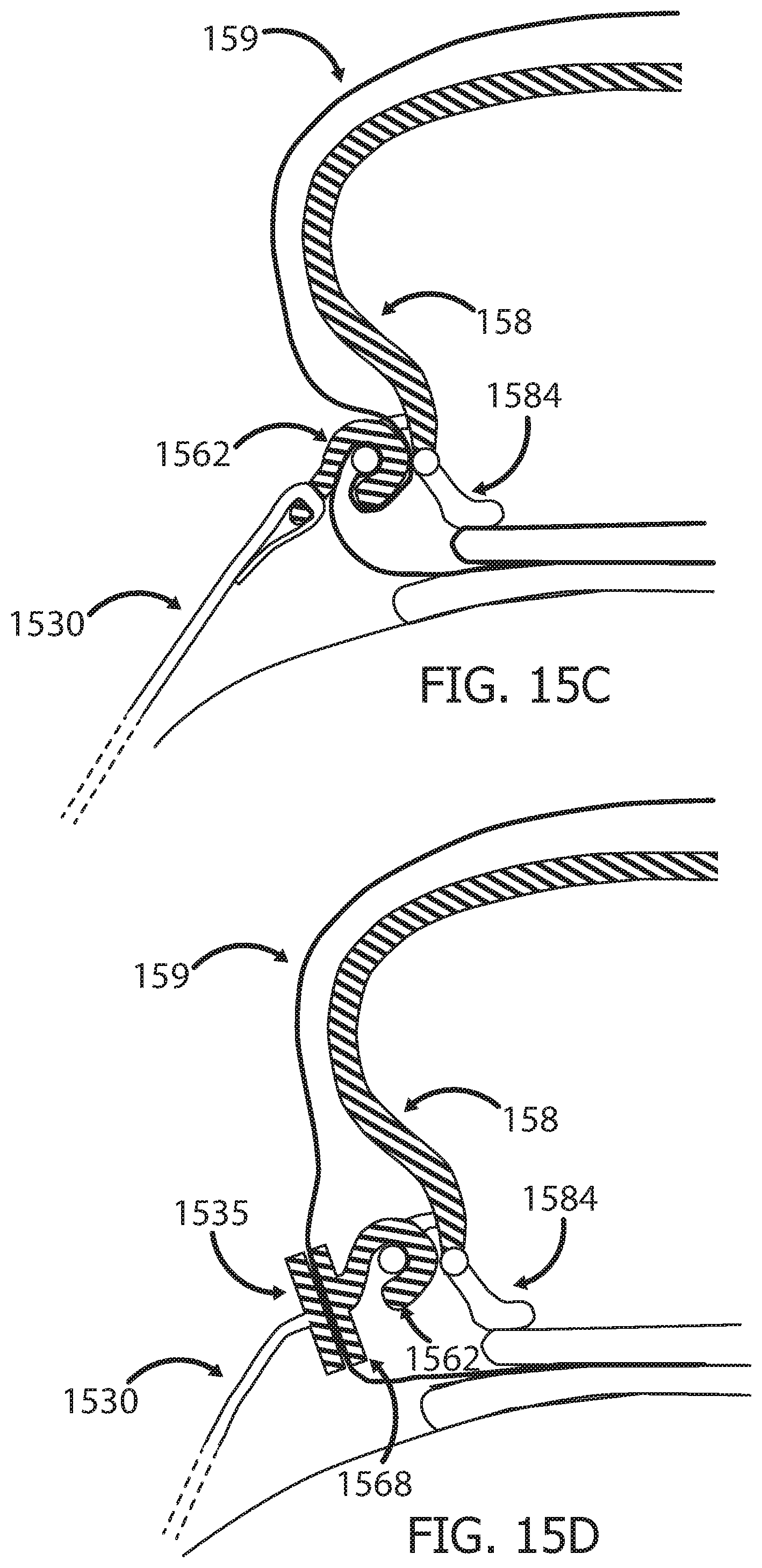 Patent US12551233 Figure 17 – Devices and methods for attaching a medical device to a subject