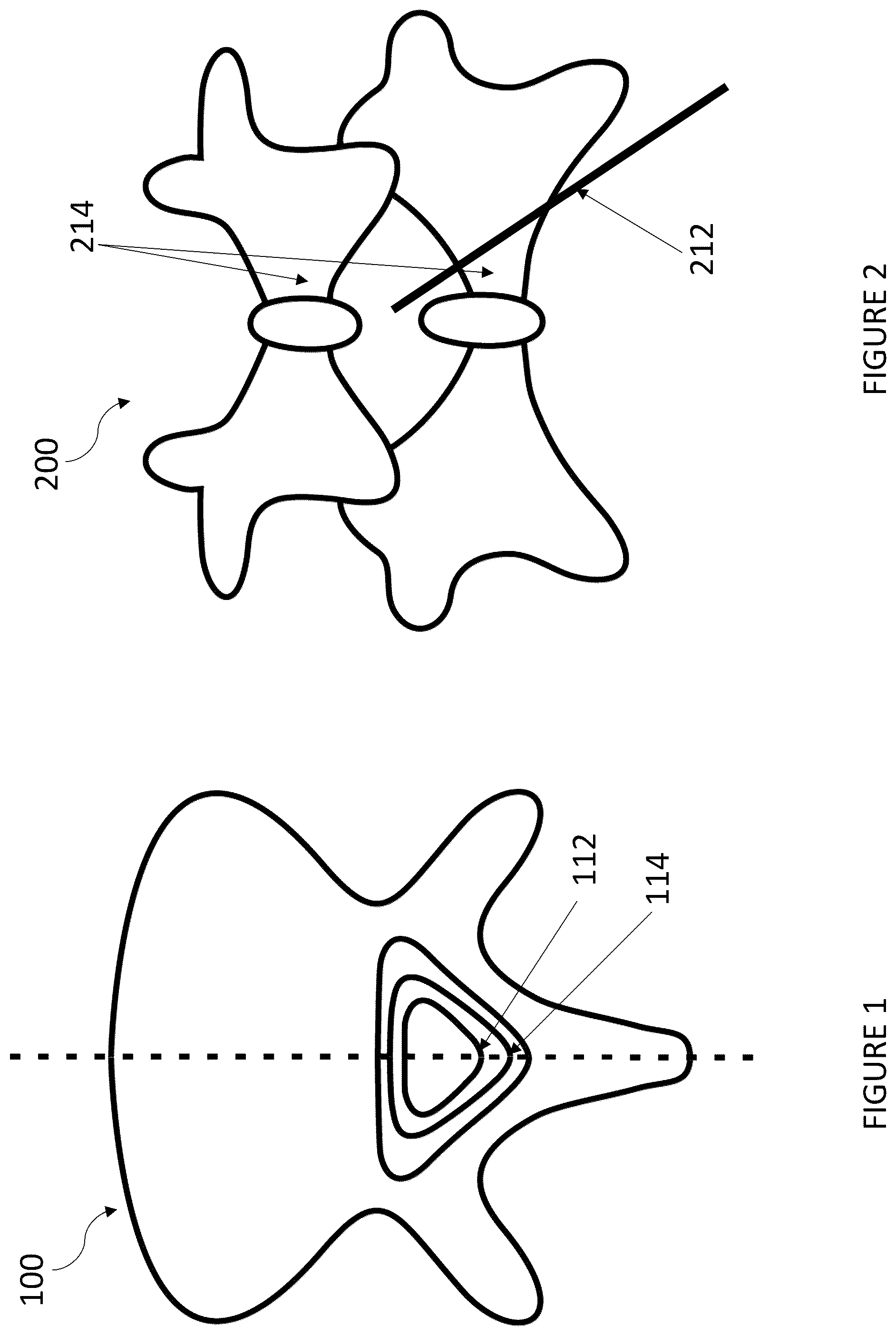 Patent US12551234 Figure 1 – Systems and method for single-operator neuraxial medical device procedures using real-time ultrasound guidance