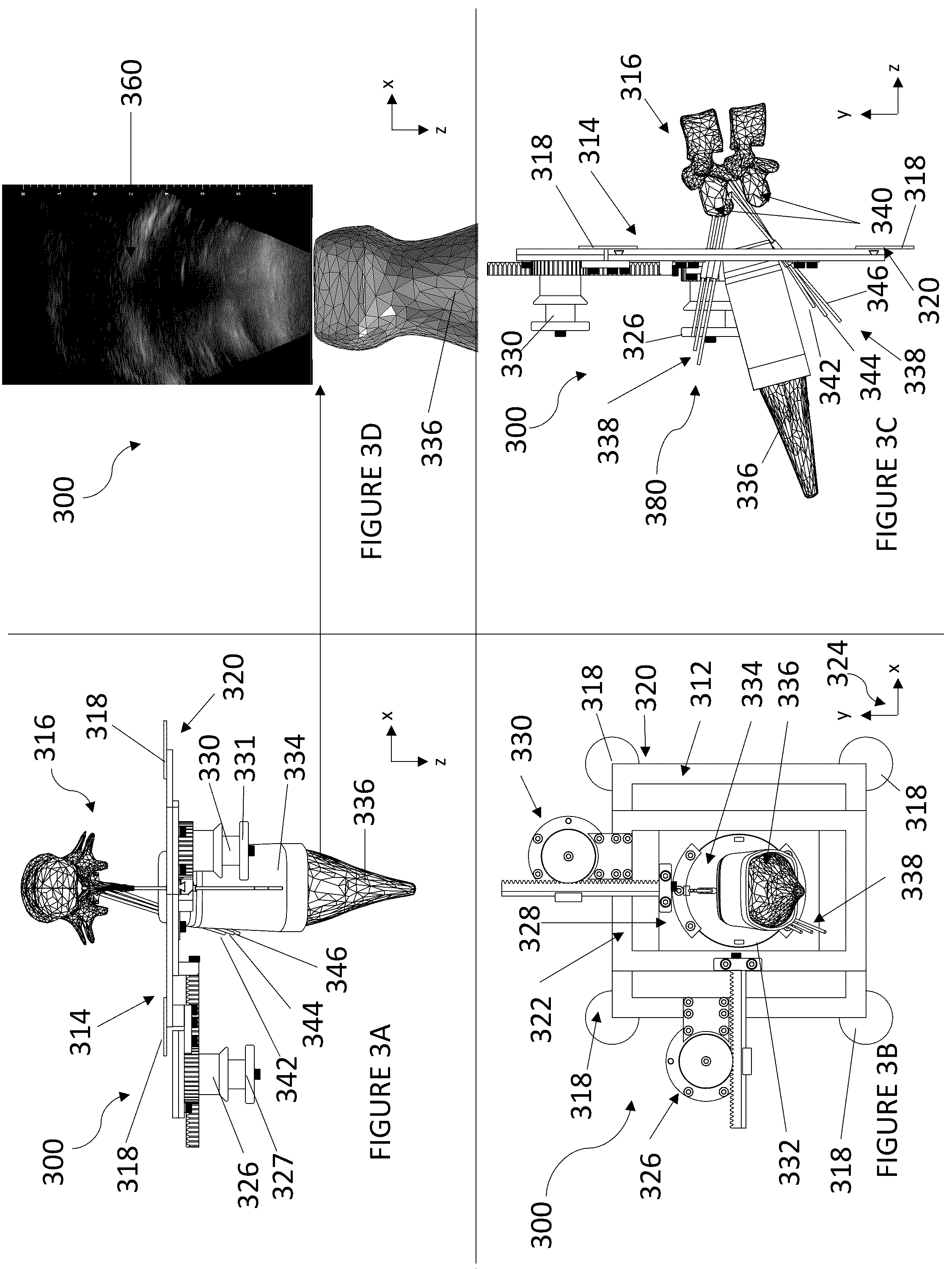 Patent US12551234 Figure 2 – Systems and method for single-operator neuraxial medical device procedures using real-time ultrasound guidance