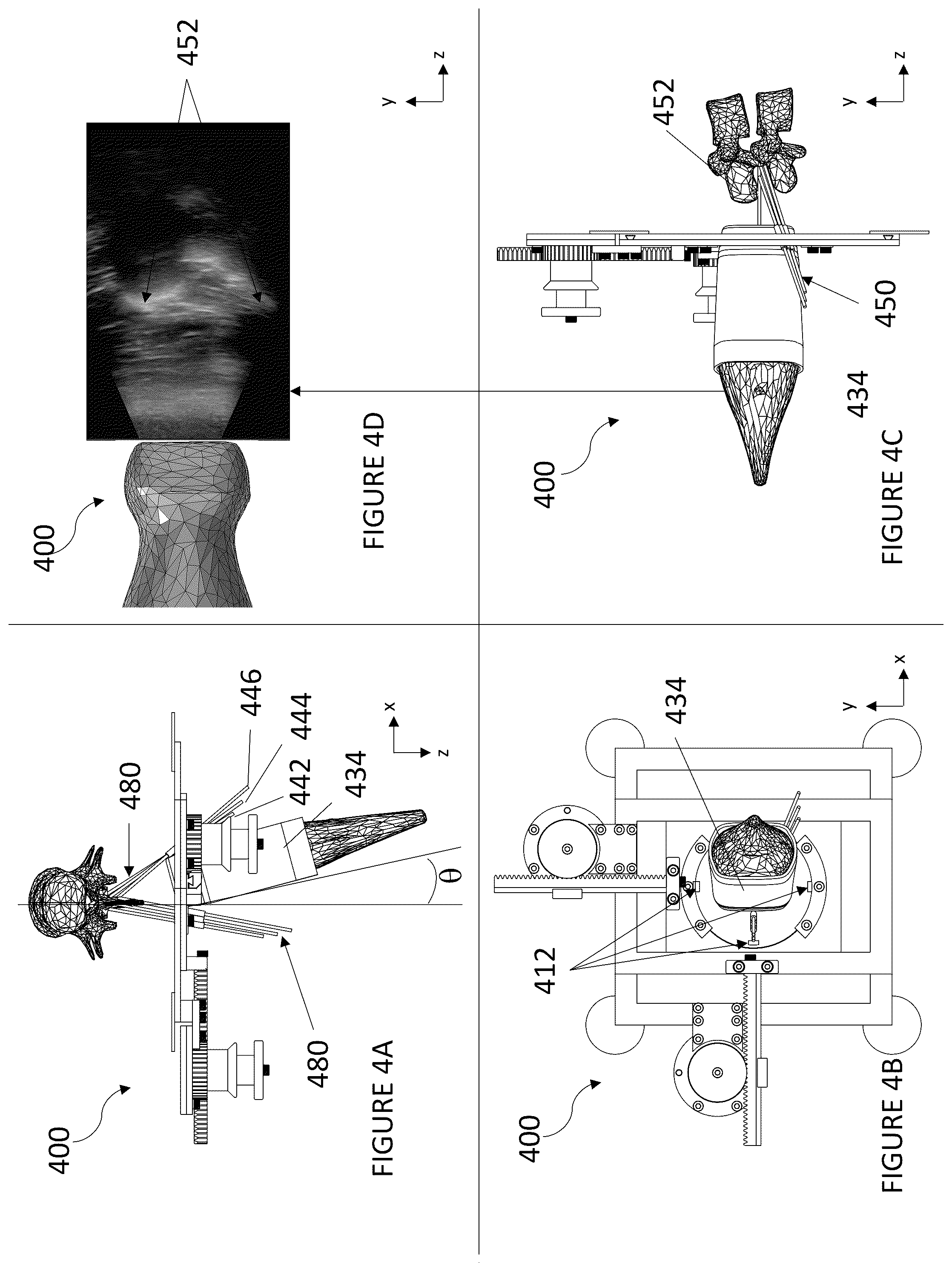 Patent US12551234 Figure 3 – Systems and method for single-operator neuraxial medical device procedures using real-time ultrasound guidance