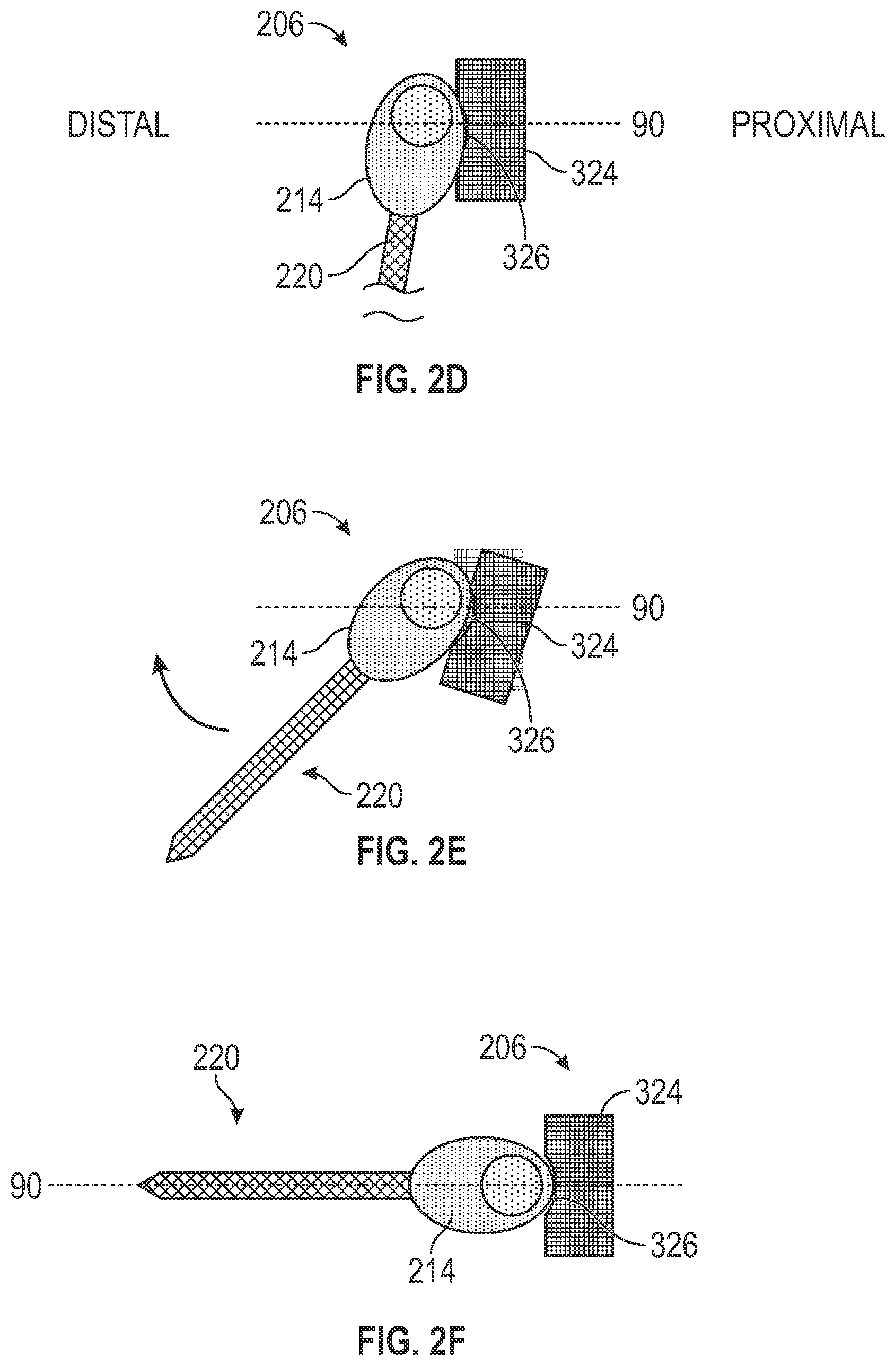 Patent US12551236 Figure 7 – Retractable intraosseous access system