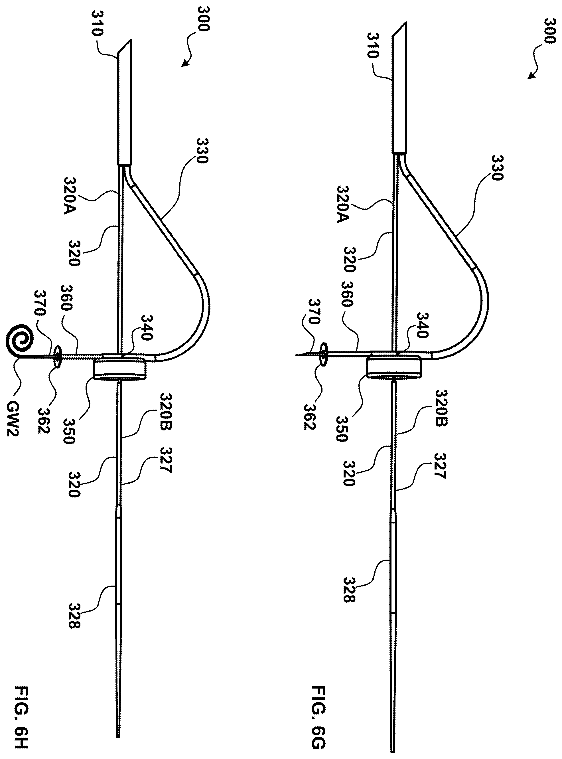 Patent US12551237 Figure 11 – Apparatus and method for septal punch