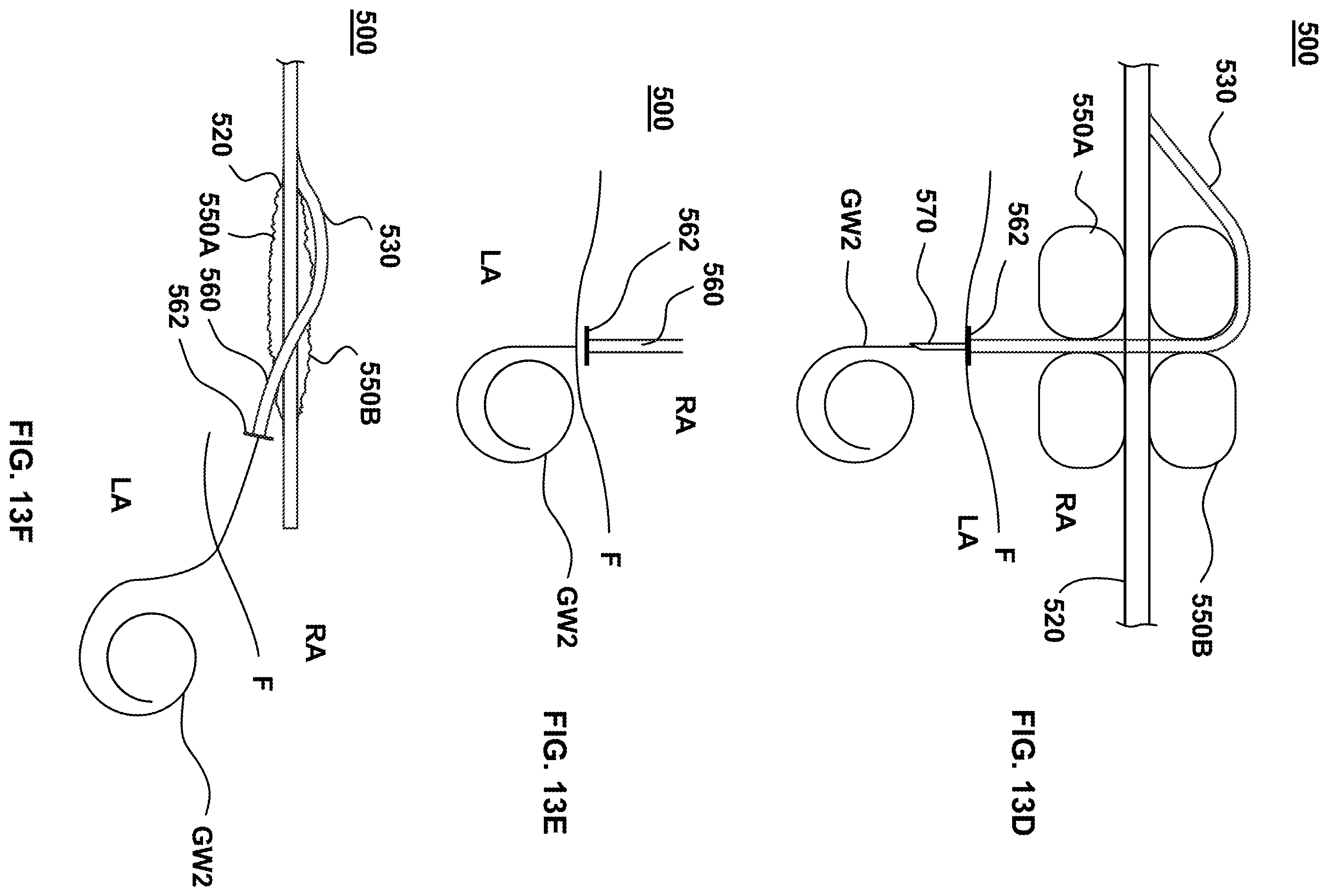 Patent US12551237 Figure 19 – Apparatus and method for septal punch