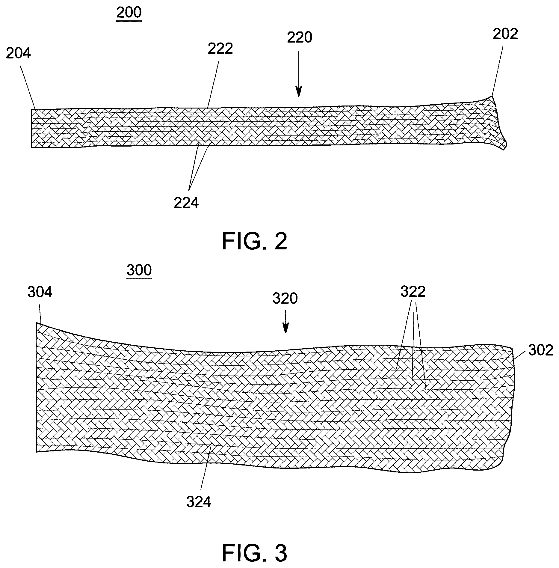 Patent US12551238 Figure 2 – Fiber implant with interwoven different materials