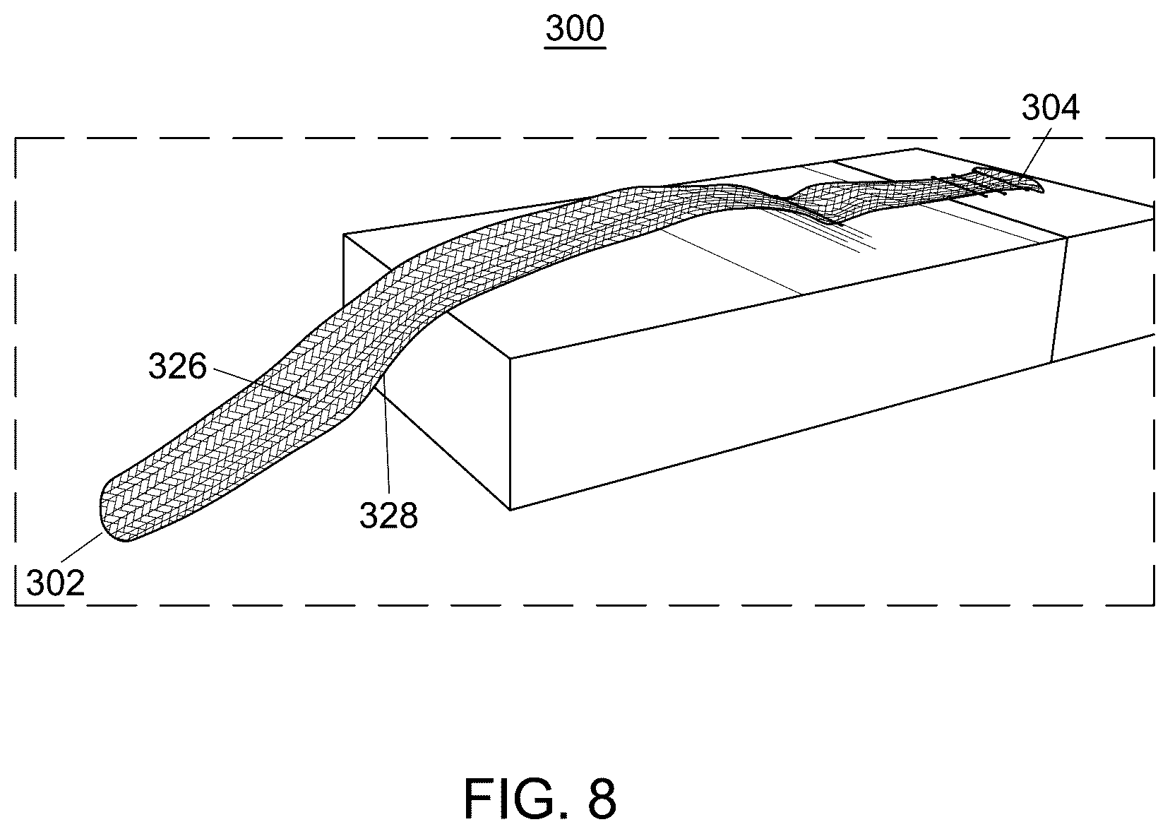 Patent US12551238 Figure 6 – Fiber implant with interwoven different materials