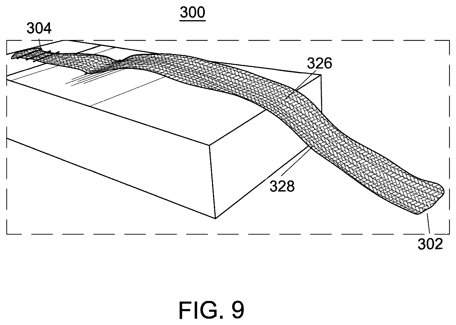 Patent US12551238 Figure 7 – Fiber implant with interwoven different materials