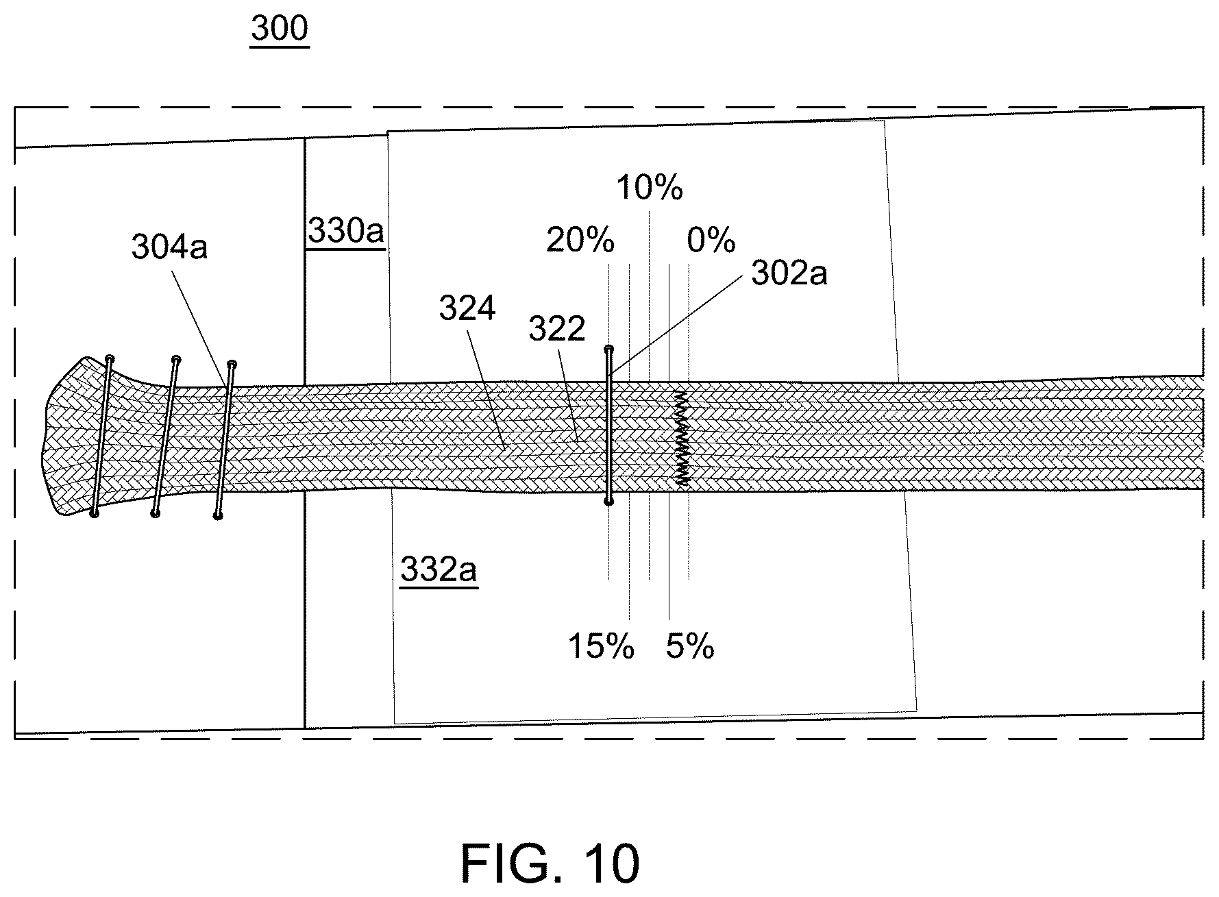 Patent US12551238 Figure 8 – Fiber implant with interwoven different materials