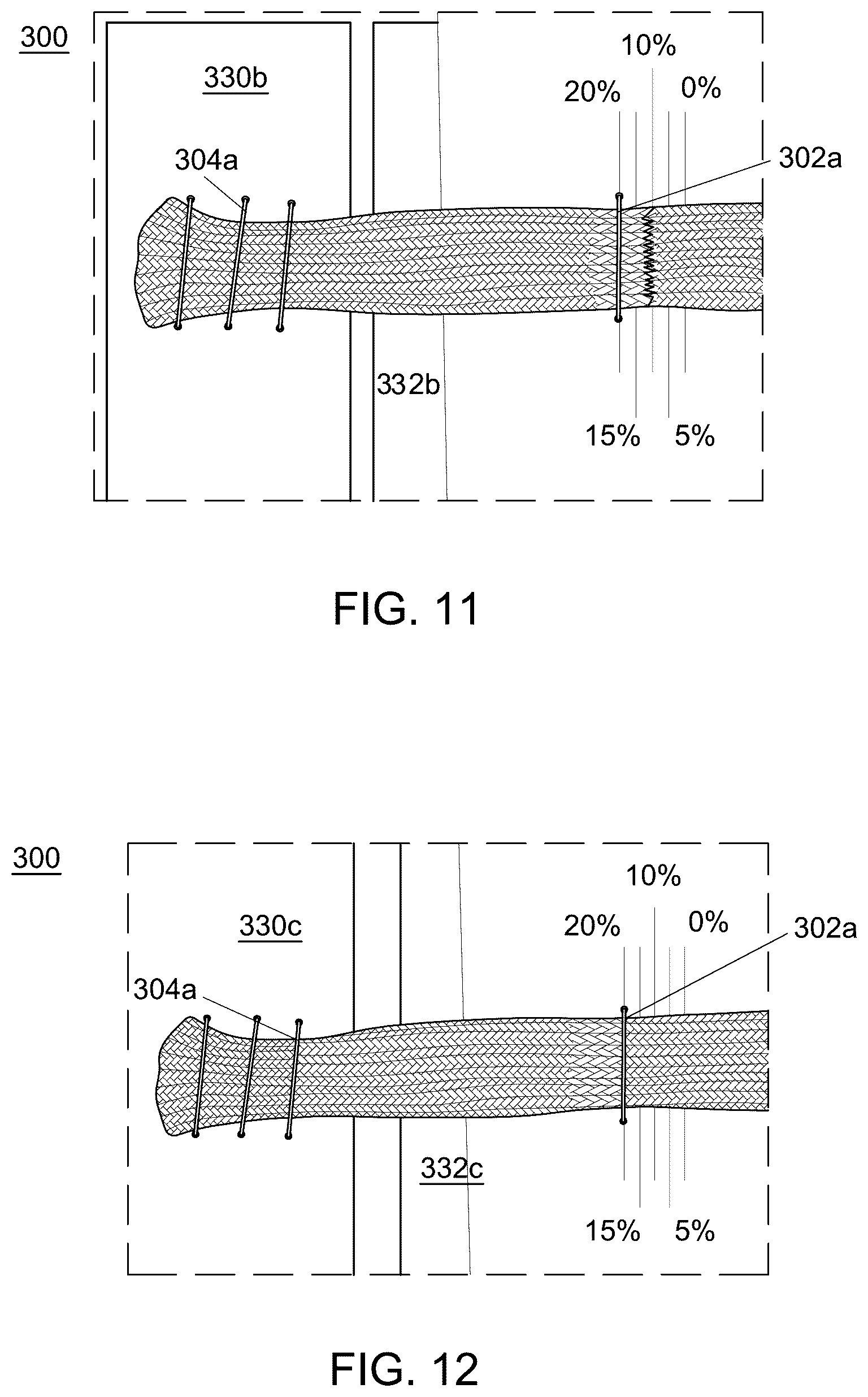 Patent US12551238 Figure 9 – Fiber implant with interwoven different materials