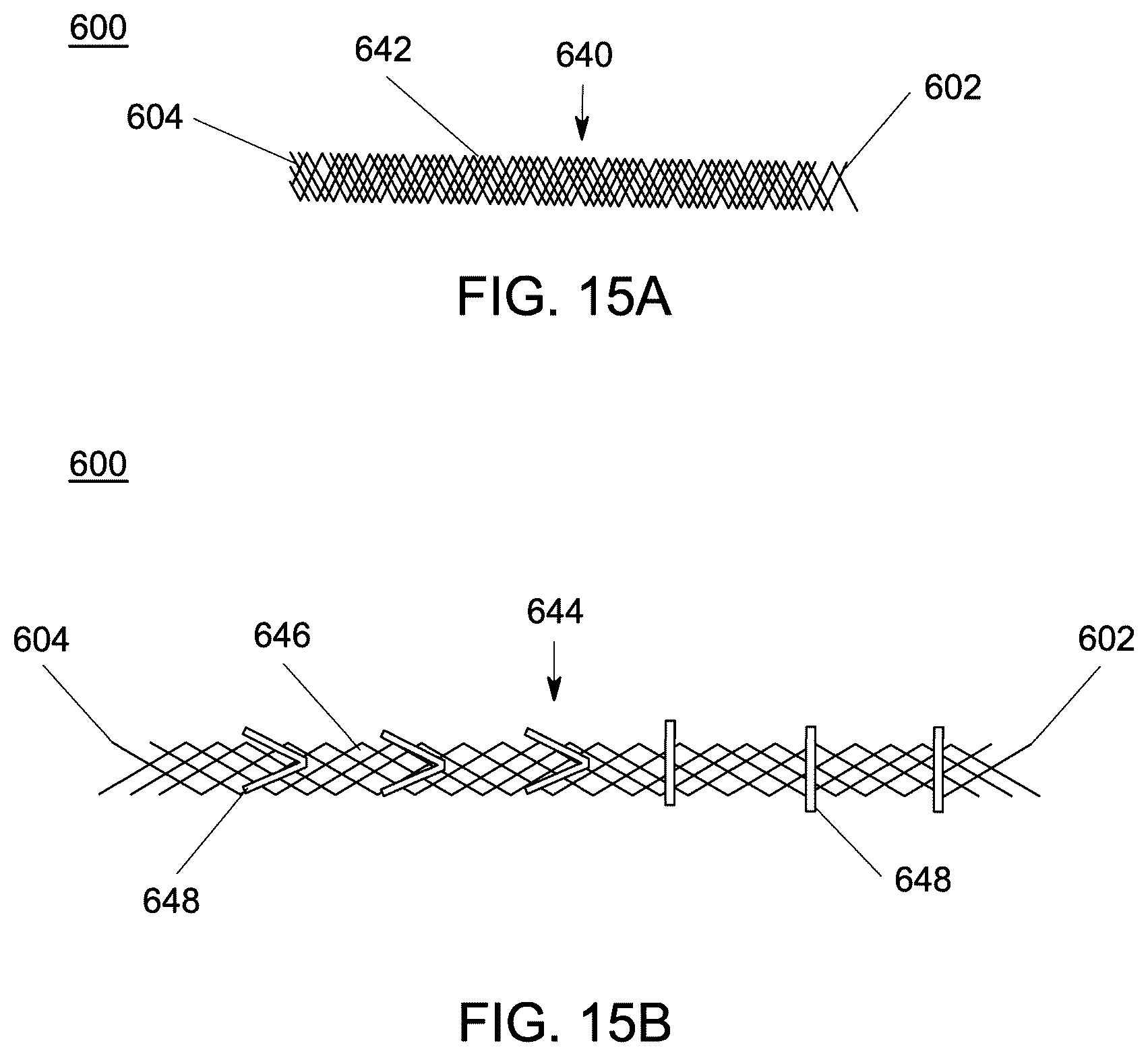 Patent US12551238 Figure 12 – Fiber implant with interwoven different materials
