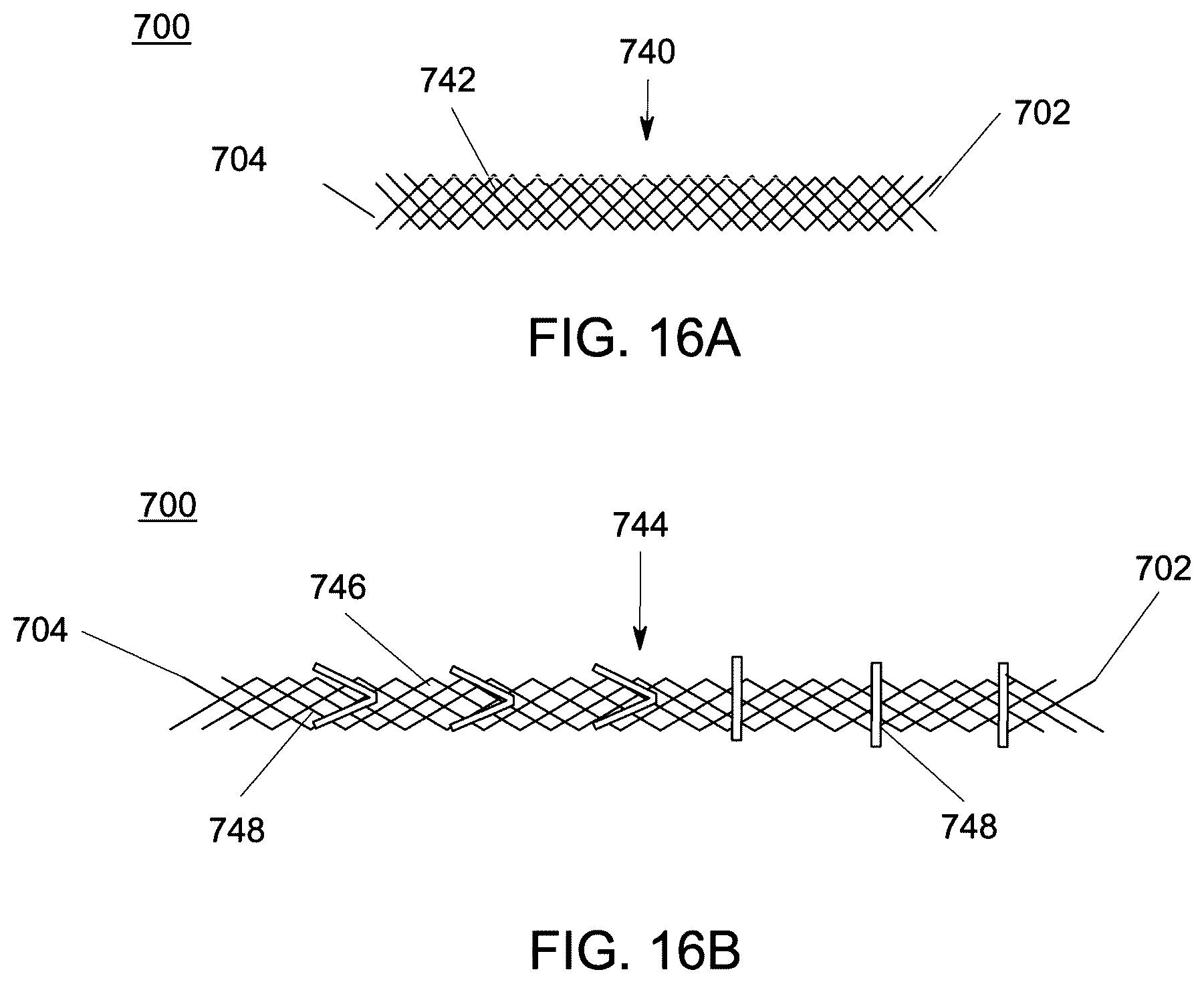 Patent US12551238 Figure 13 – Fiber implant with interwoven different materials