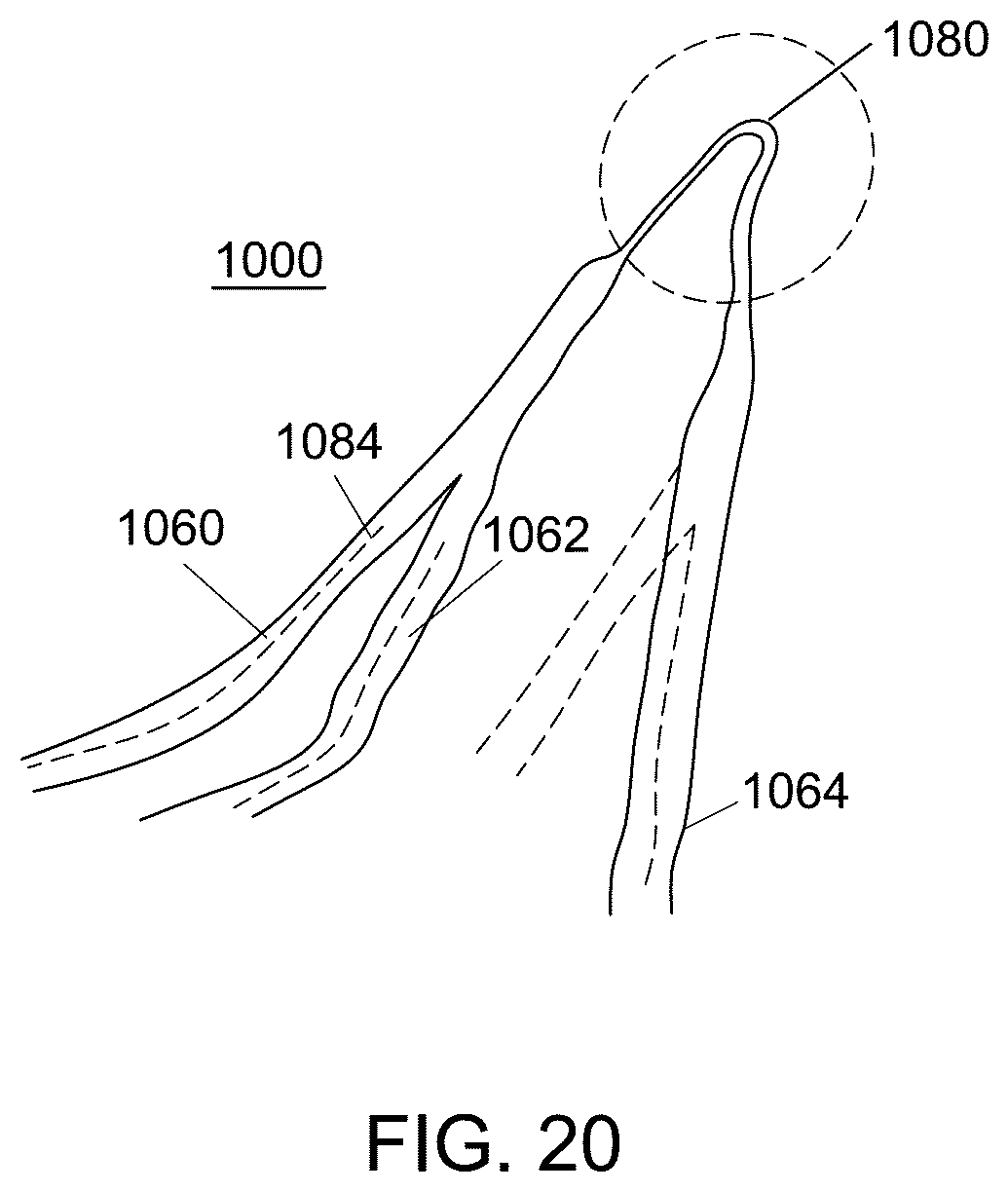 Patent US12551238 Figure 17 – Fiber implant with interwoven different materials