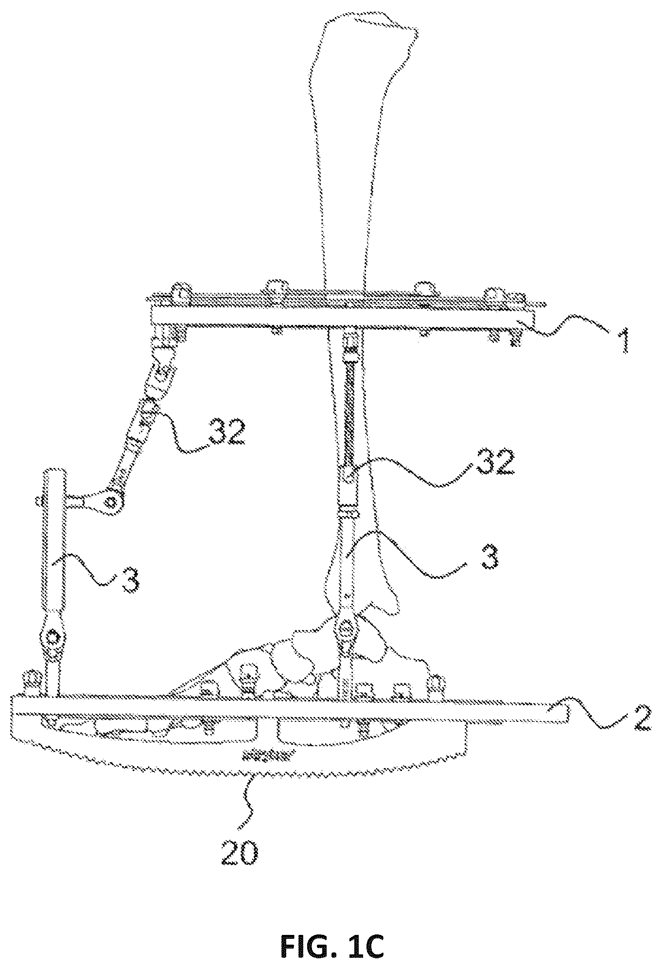 Patent US12551239 Figure 3 – External fixator system