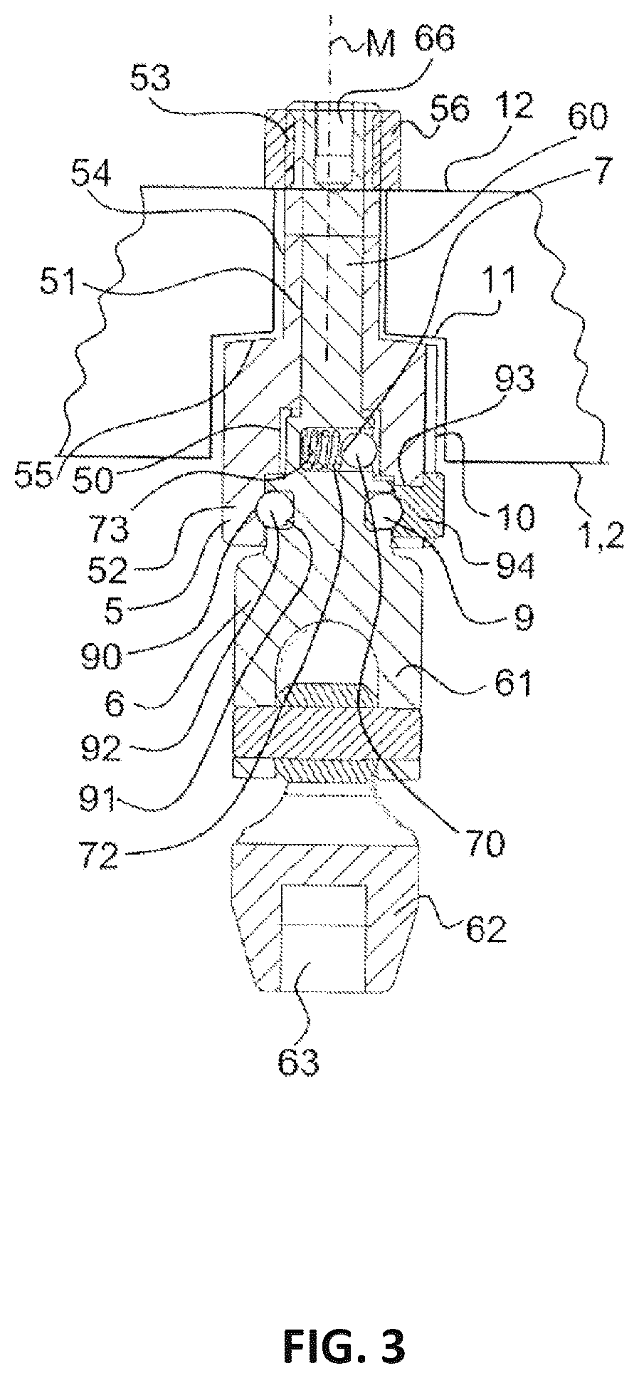 Patent US12551239 Figure 5 – External fixator system