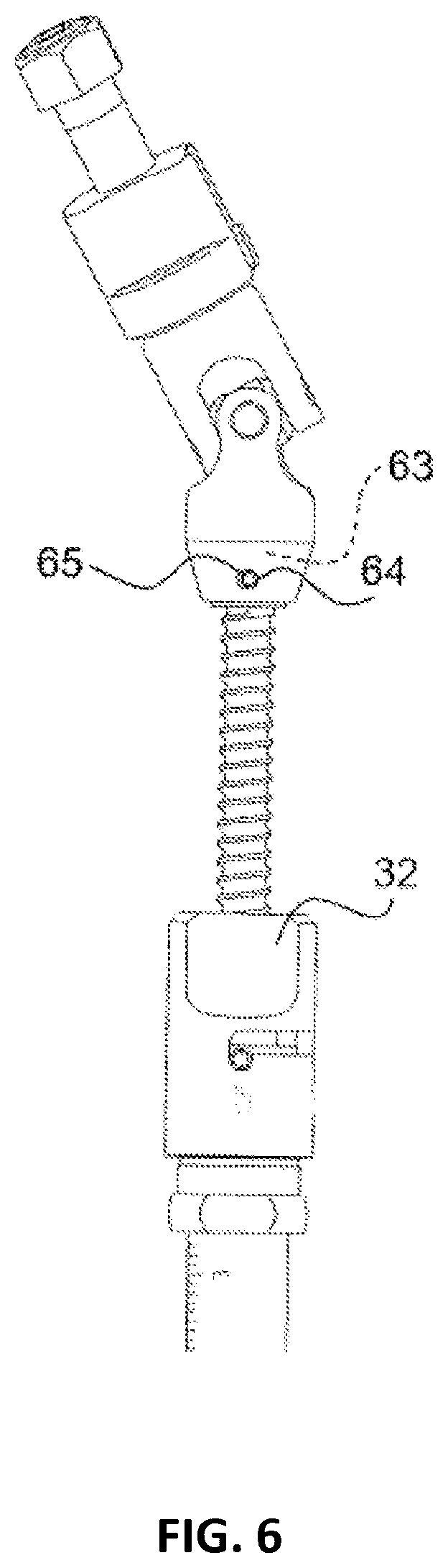 Patent US12551239 Figure 8 – External fixator system