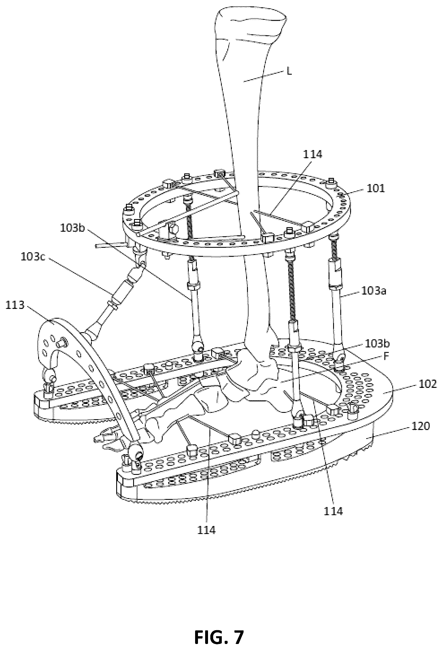 Patent US12551239 Figure 9 – External fixator system