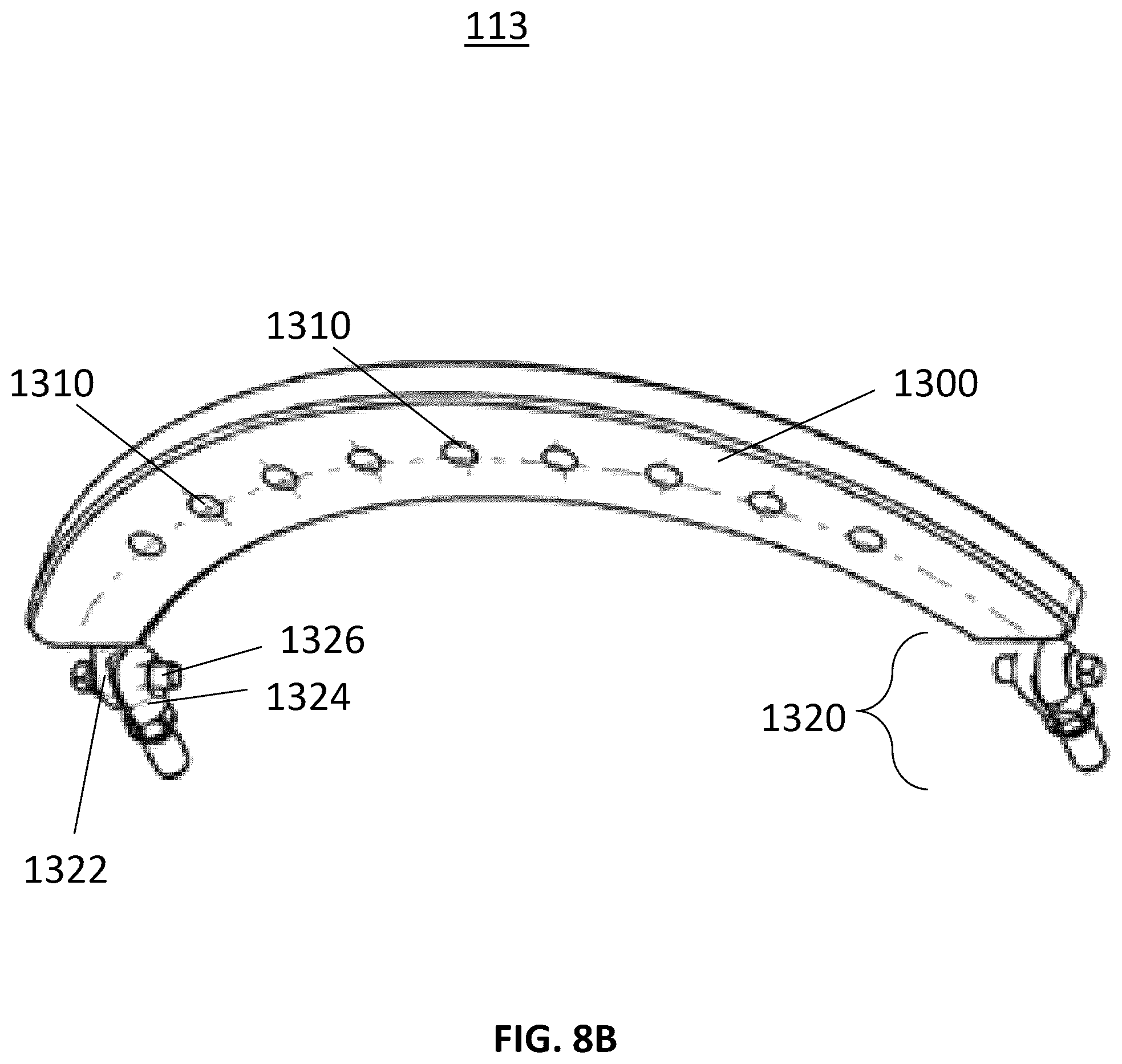 Patent US12551239 Figure 11 – External fixator system