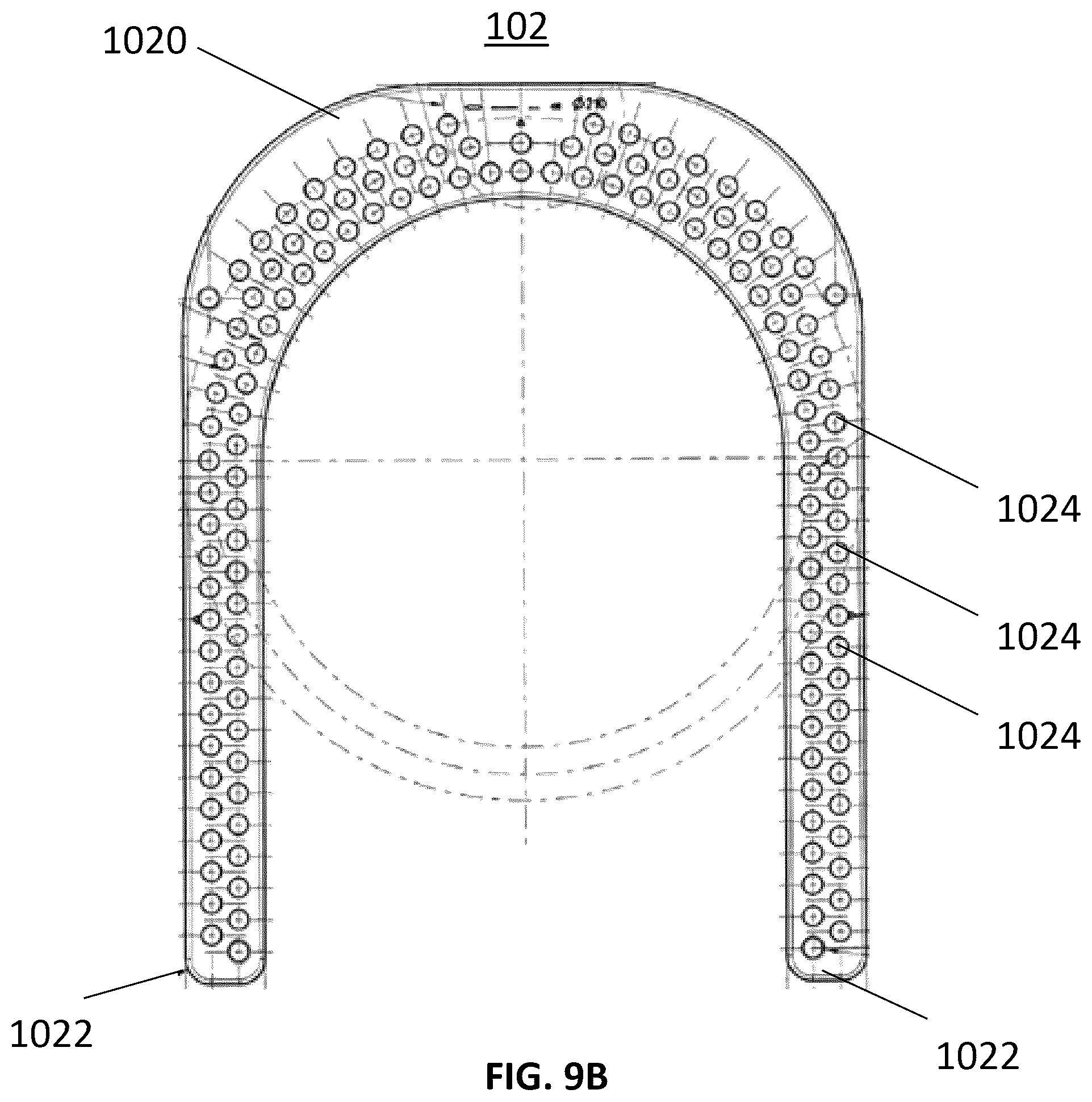Patent US12551239 Figure 14 – External fixator system