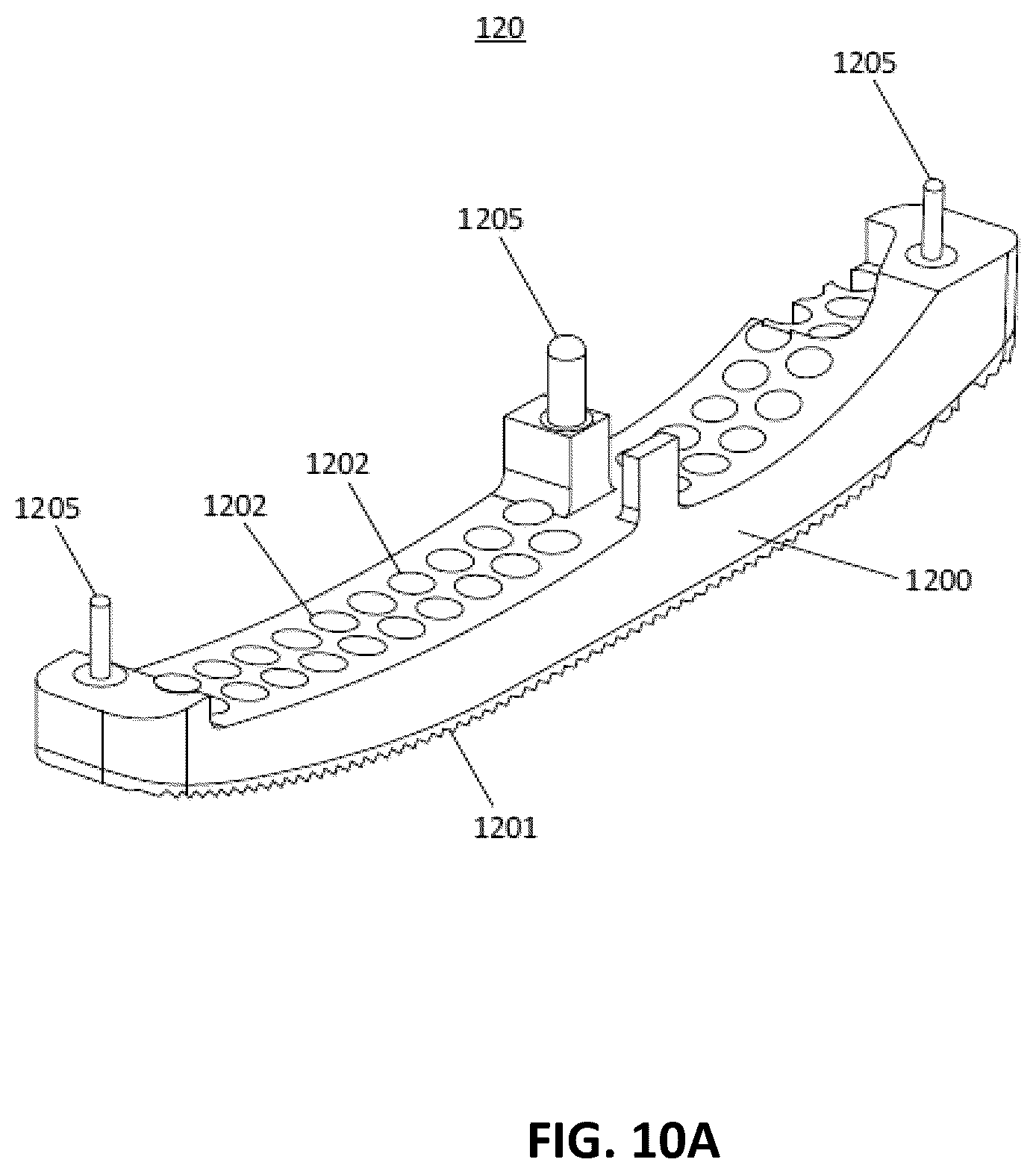 Patent US12551239 Figure 15 – External fixator system