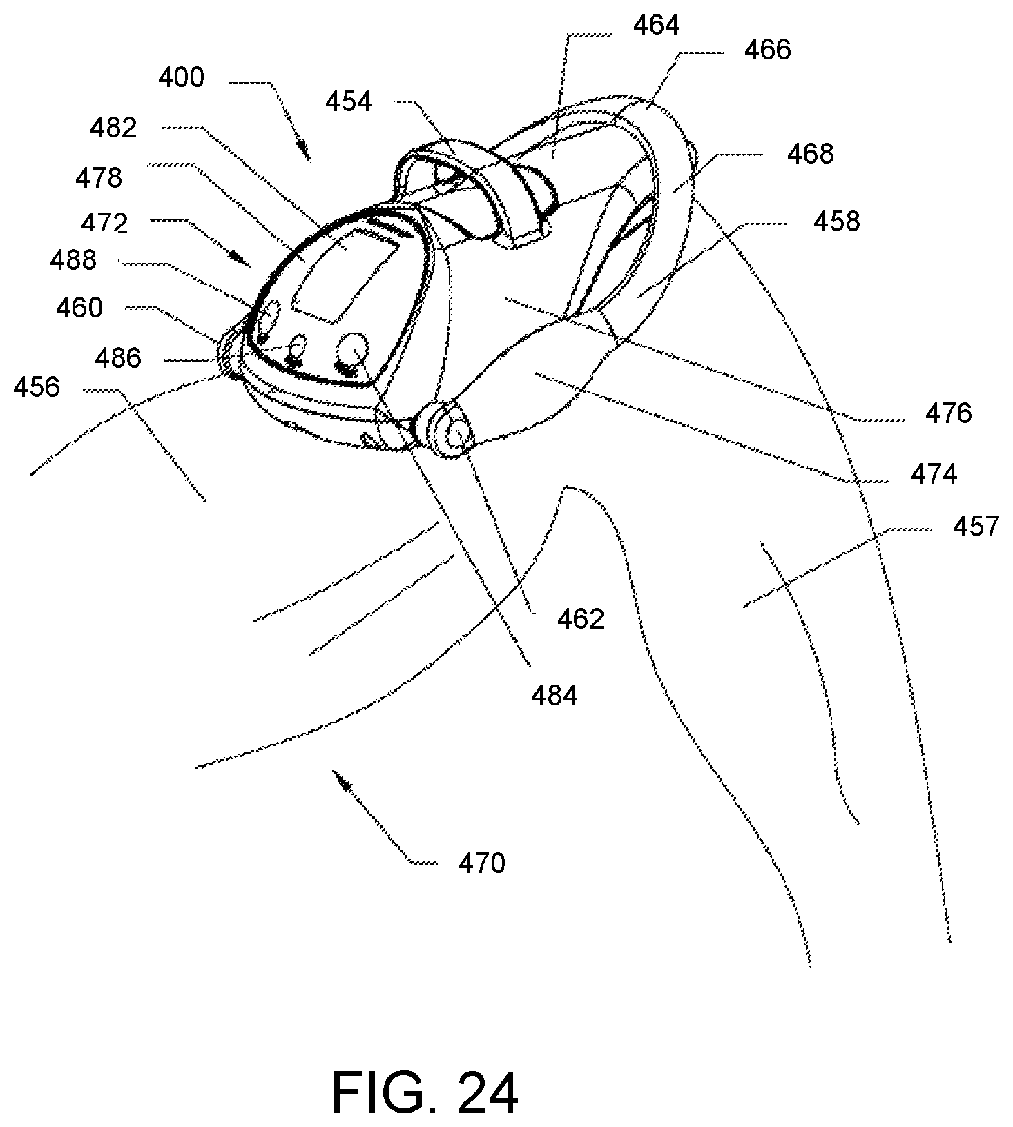 Patent US12551240 Figure 10 – Distraction loss magnet on-off mechanism