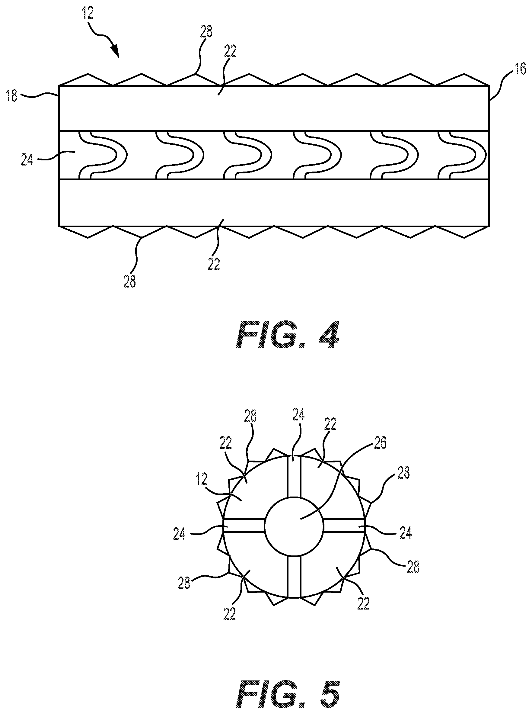 Patent US12551241 Figure 3 – Expandable bone core for pedicle screw fixation