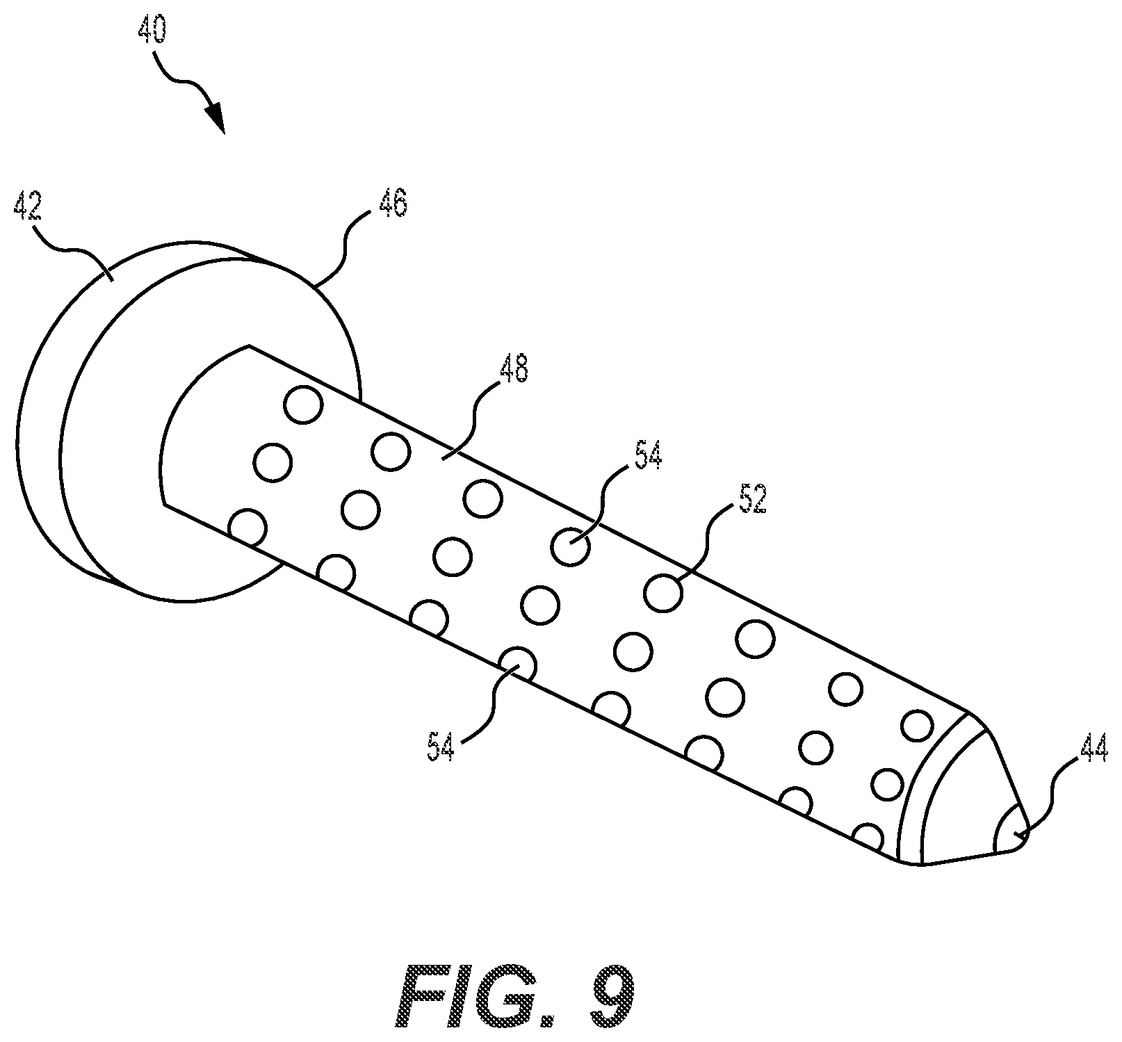 Patent US12551241 Figure 6 – Expandable bone core for pedicle screw fixation