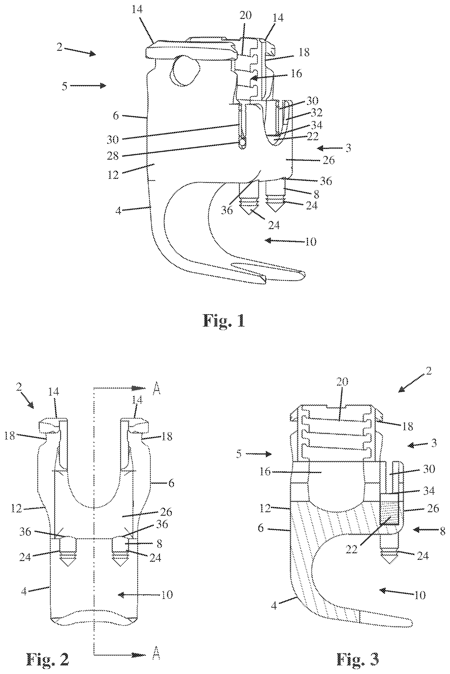 Patent US12551242 Figure 1 – Bone anchor with deployable purchase element