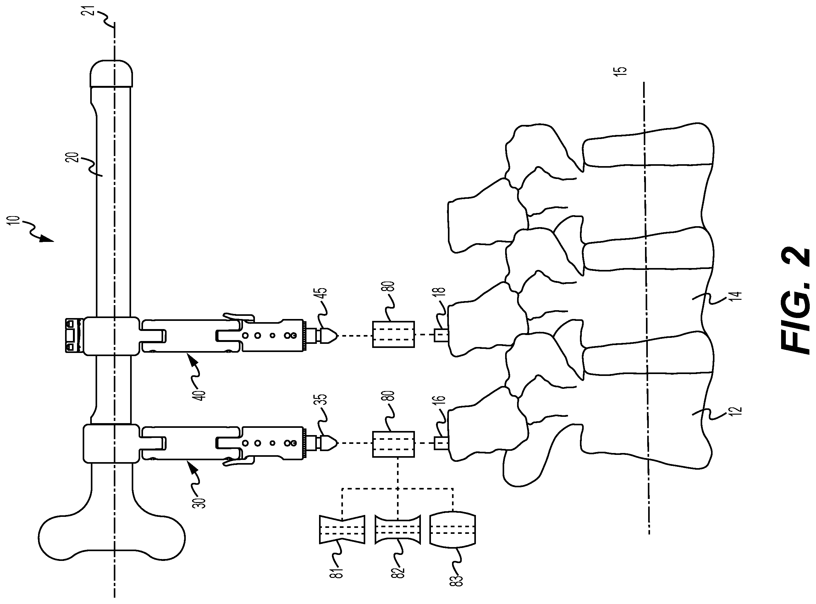 Patent US12551243 Figure 2 – Adjustable, modular instrument and method for spinal manipulation