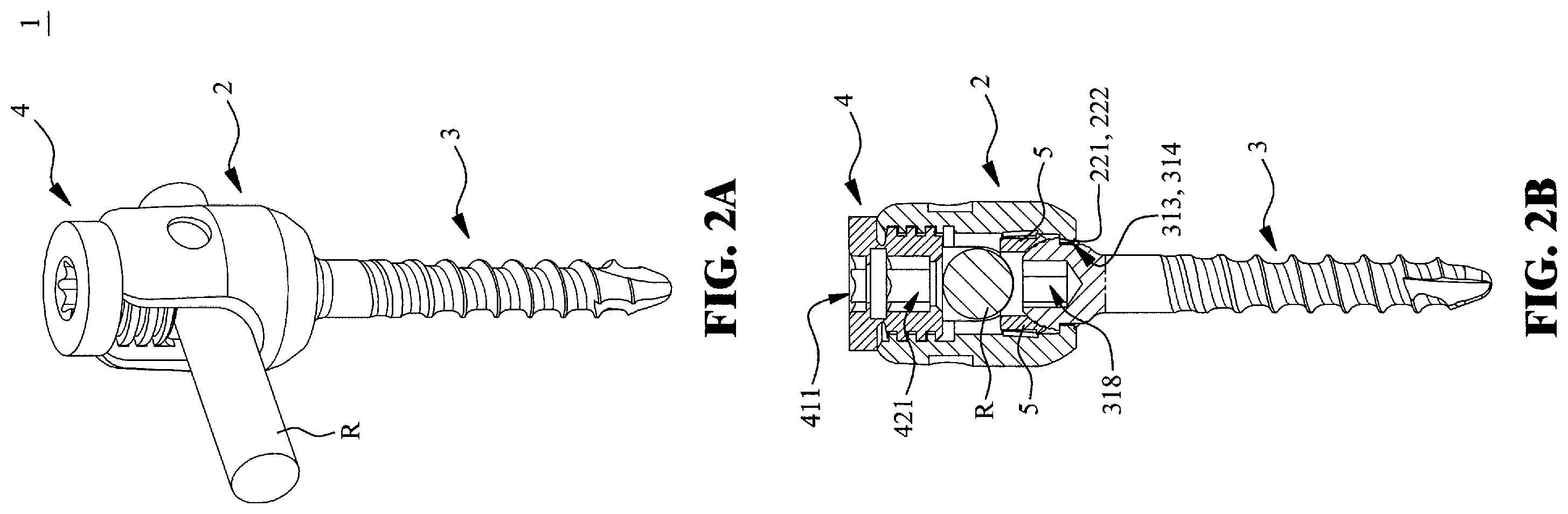 Patent US12551244 Figure 2 – Pedicle screw switchable between monoaxial mode and polyaxial mode