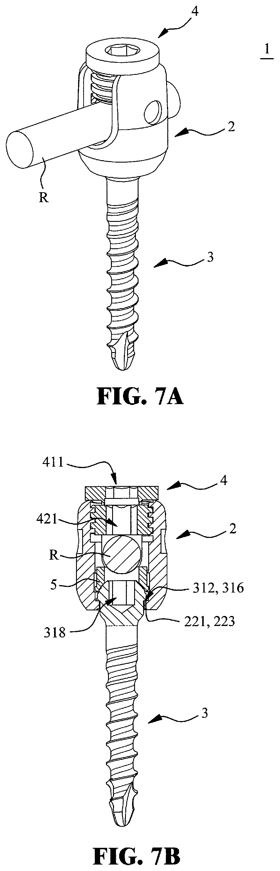 Patent US12551244 Figure 5 – Pedicle screw switchable between monoaxial mode and polyaxial mode