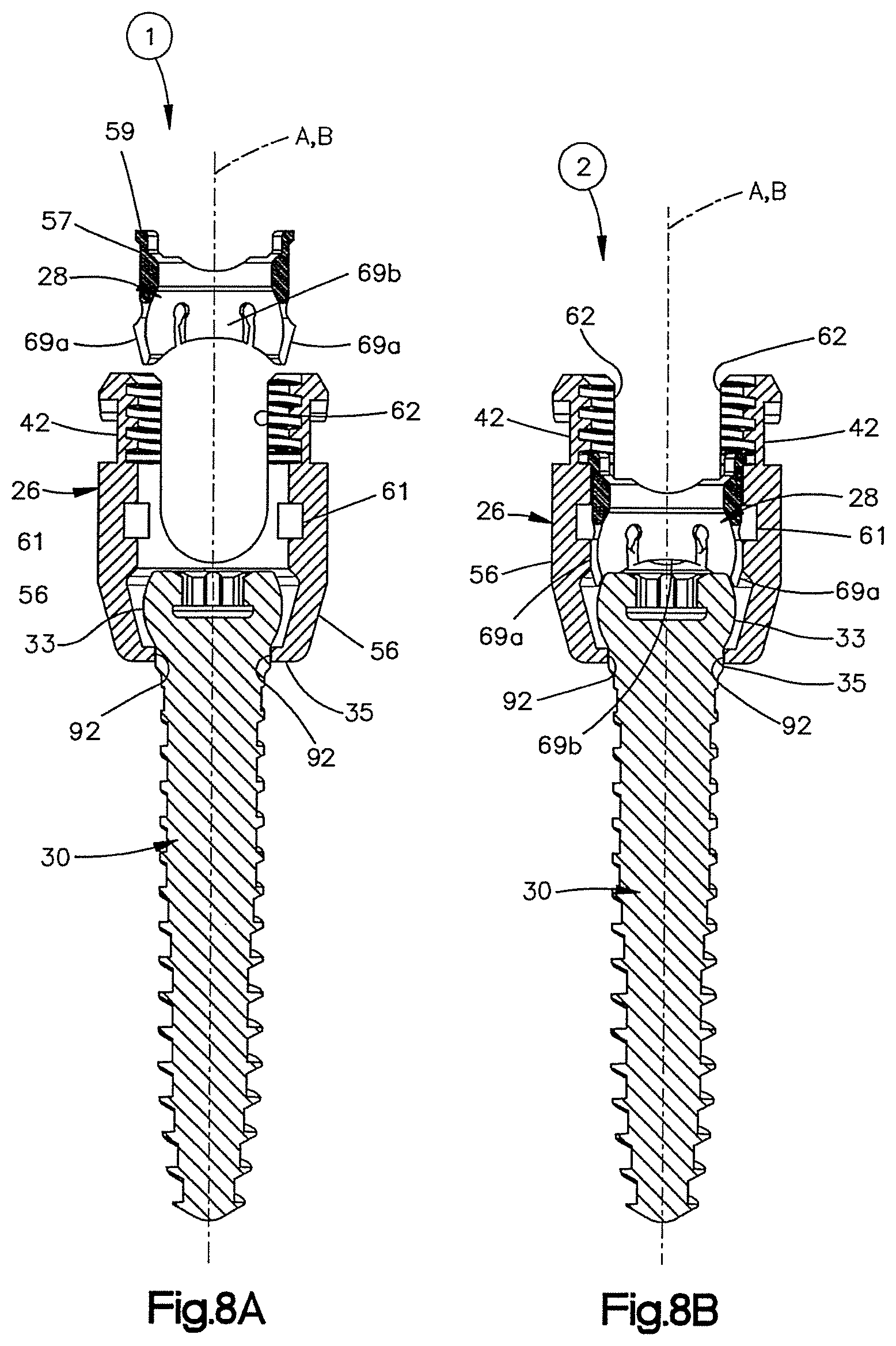 Patent US12551245 Figure 8 – Uni-planer bone fixation assembly
