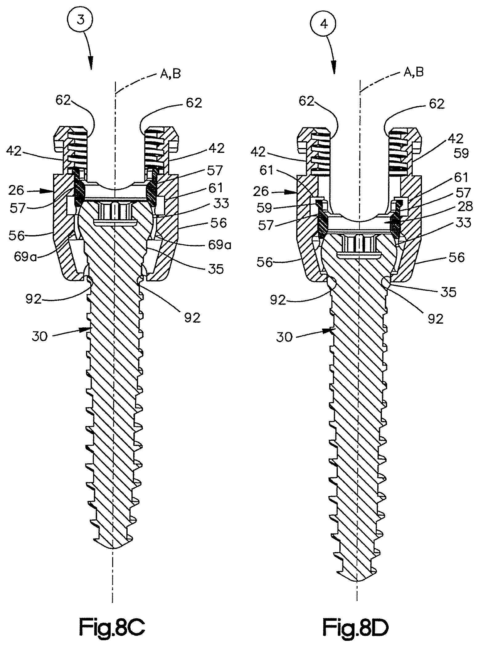 Patent US12551245 Figure 9 – Uni-planer bone fixation assembly