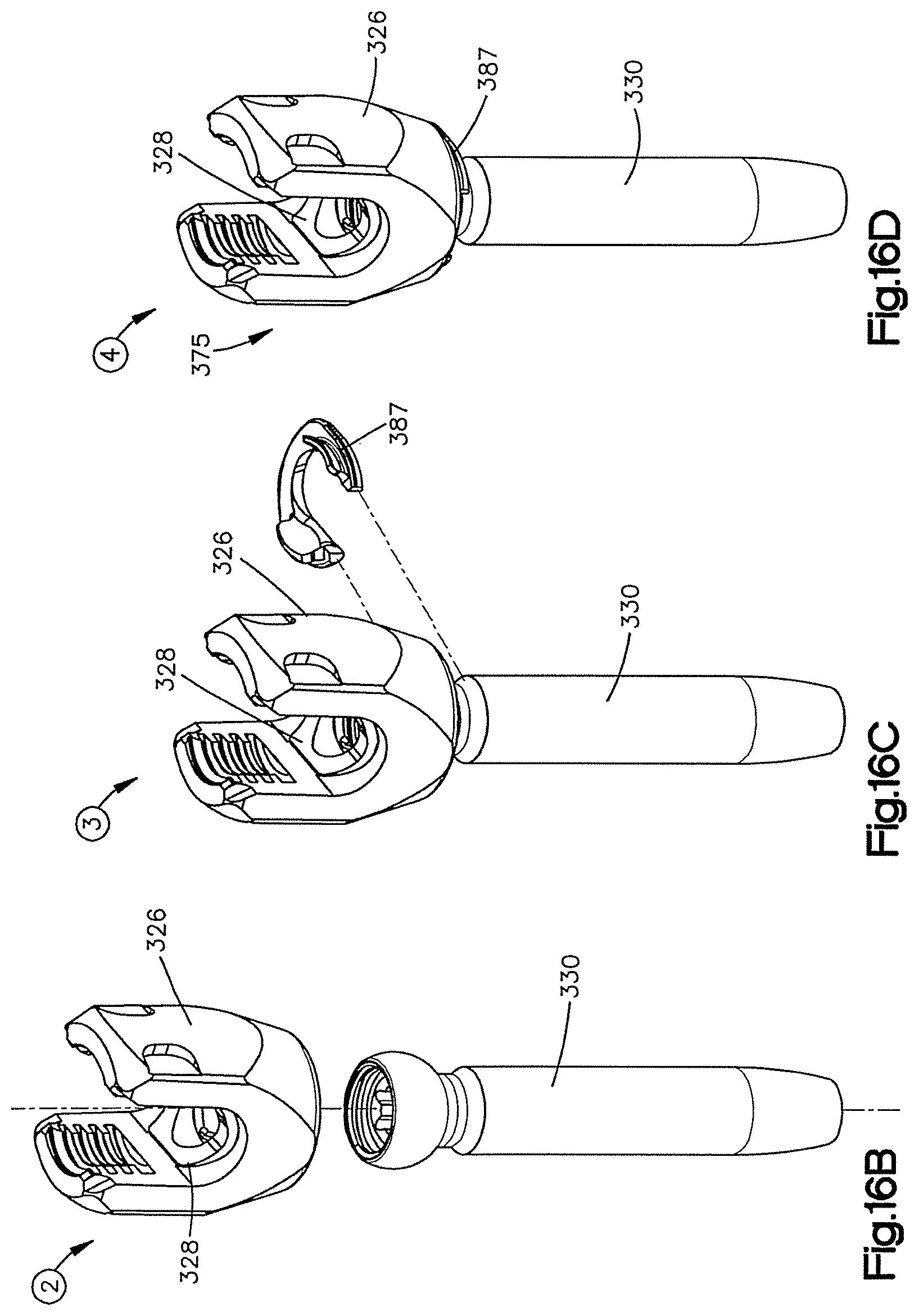 Patent US12551245 Figure 18 – Uni-planer bone fixation assembly