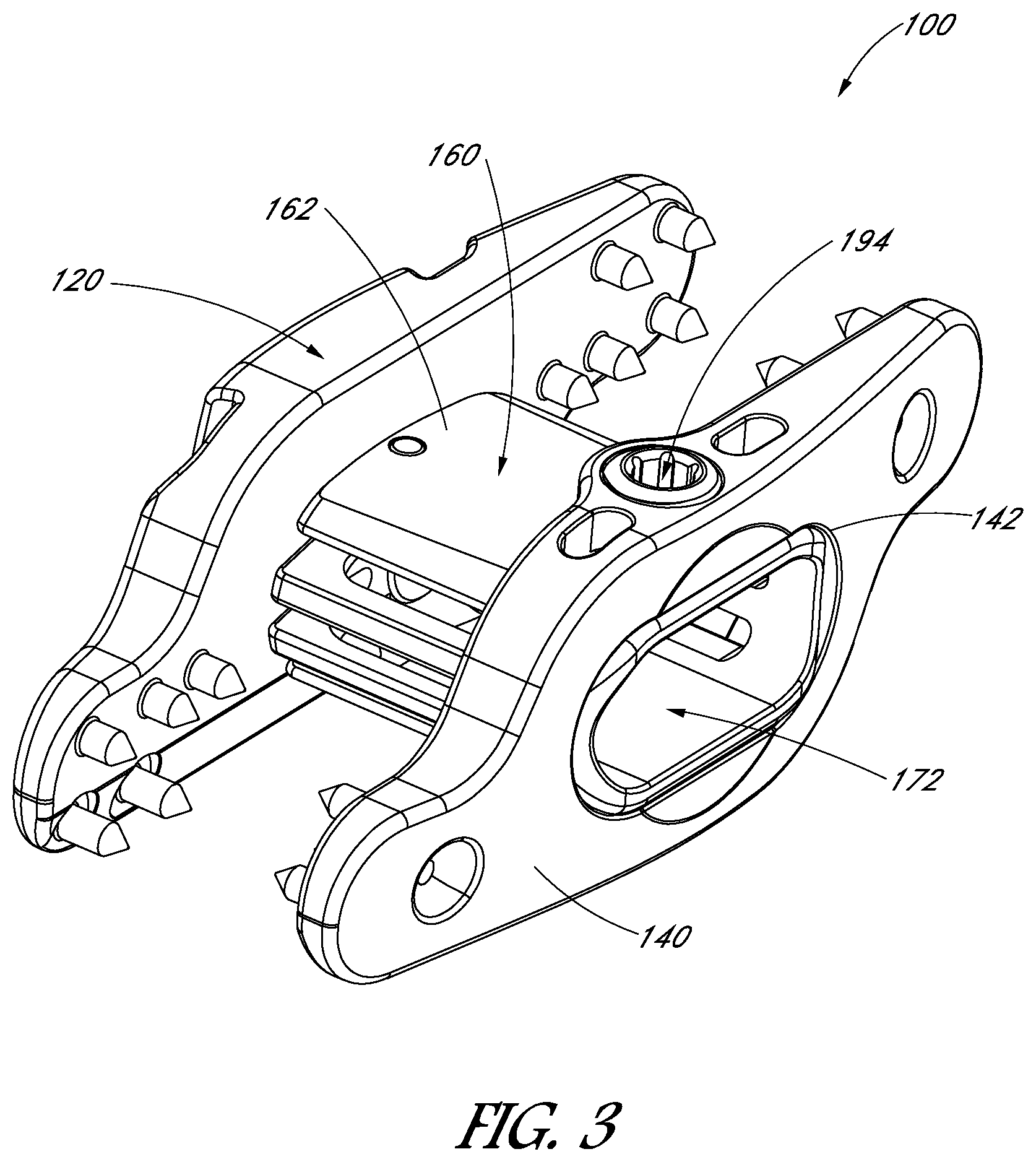 Patent US12551246 Figure 3 – Apparatus and method of treating spinous processes
