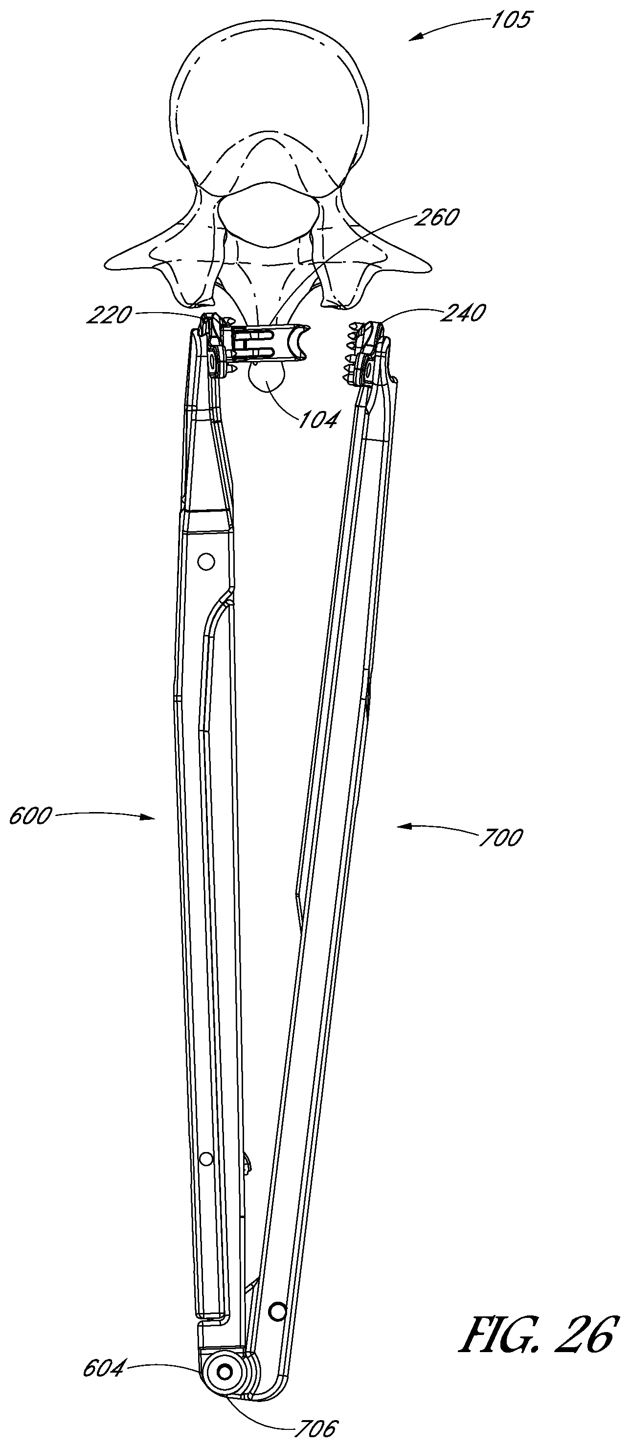 Patent US12551246 Figure 18 – Apparatus and method of treating spinous processes