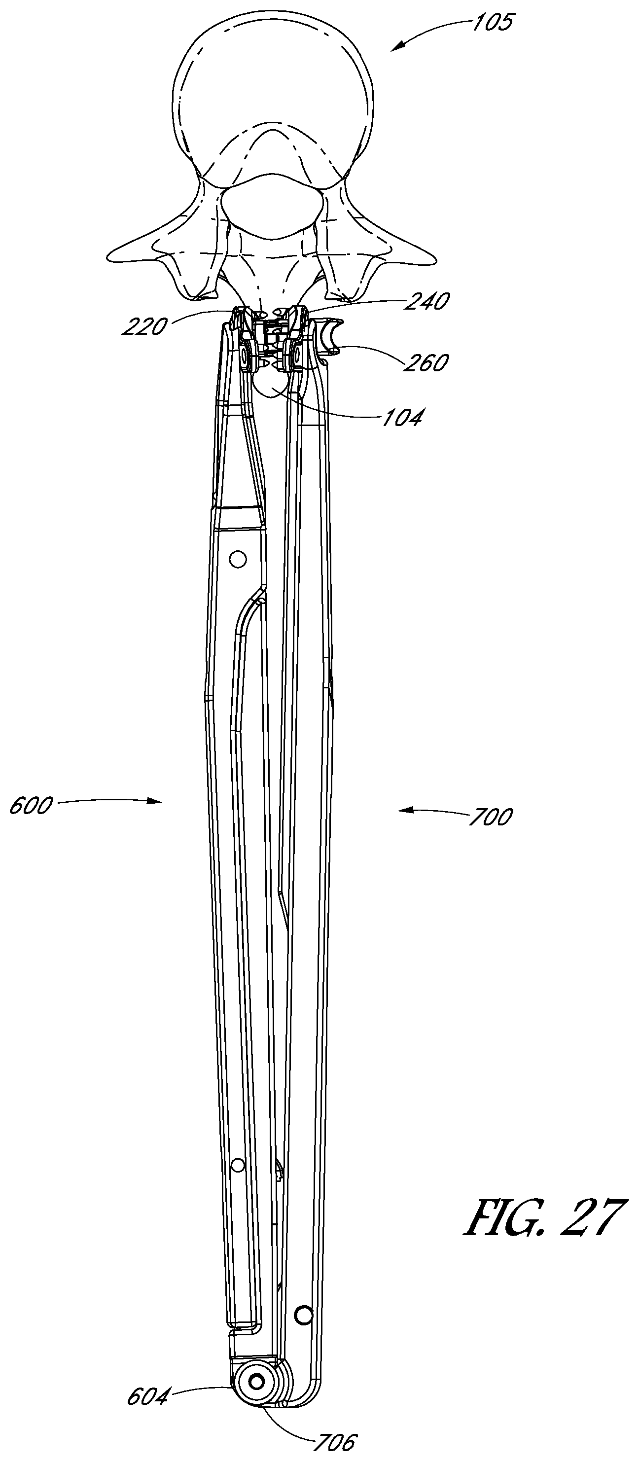 Patent US12551246 Figure 19 – Apparatus and method of treating spinous processes