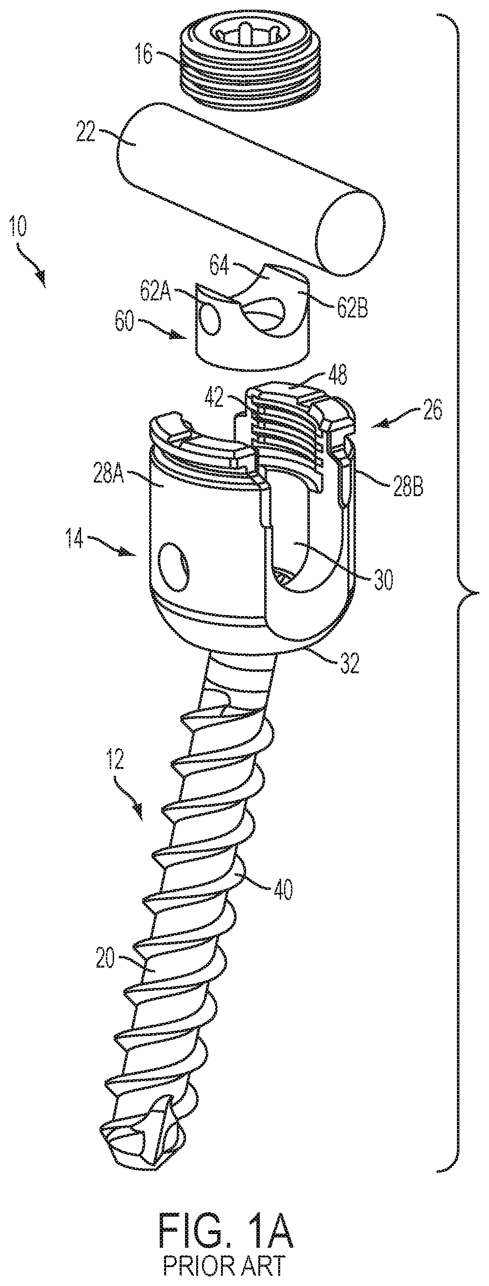 Patent US12551247 Figure 1 – Bone anchors and surgical instruments with integrated guide tips