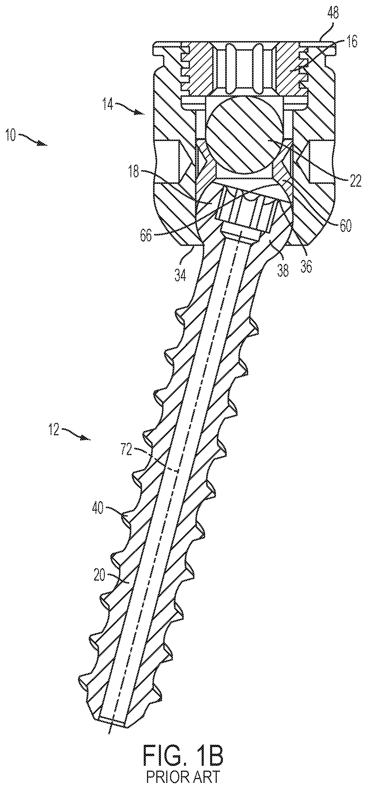 Patent US12551247 Figure 2 – Bone anchors and surgical instruments with integrated guide tips