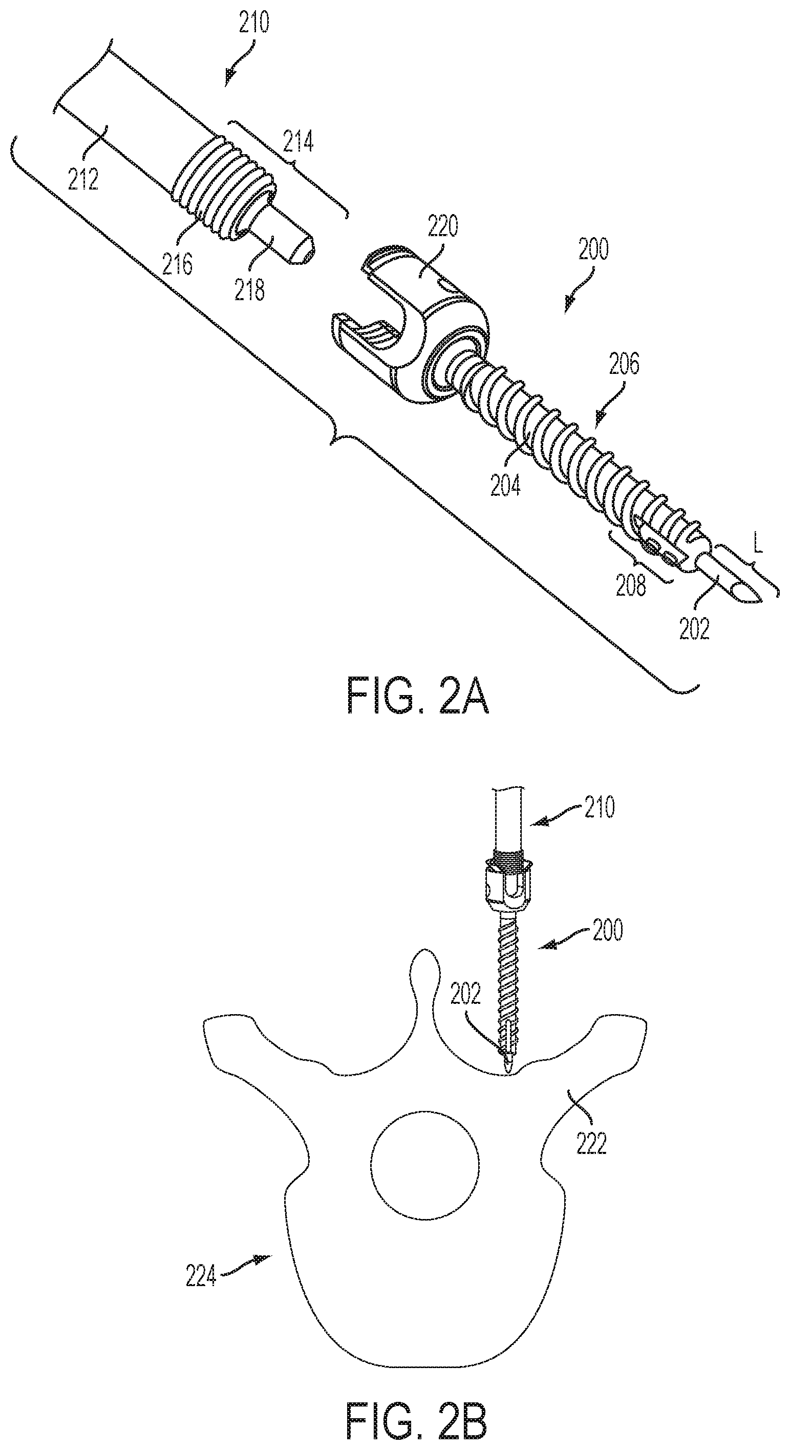 Patent US12551247 Figure 3 – Bone anchors and surgical instruments with integrated guide tips