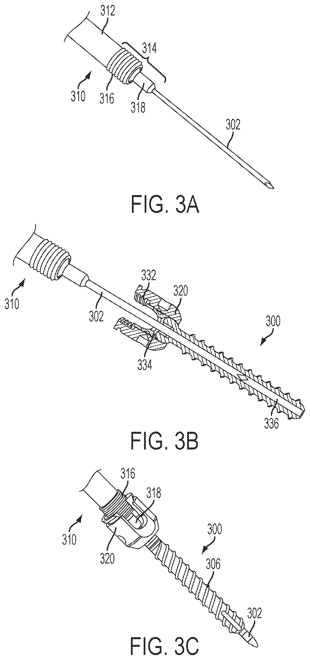 Patent US12551247 Figure 6 – Bone anchors and surgical instruments with integrated guide tips