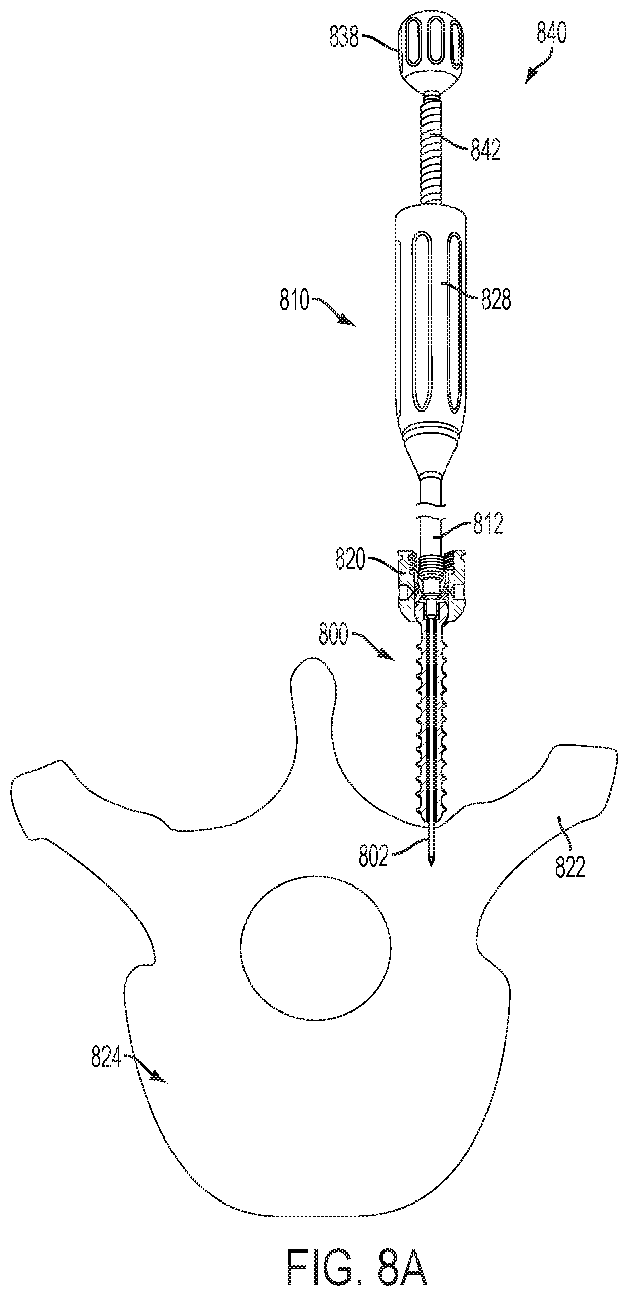 Patent US12551247 Figure 16 – Bone anchors and surgical instruments with integrated guide tips