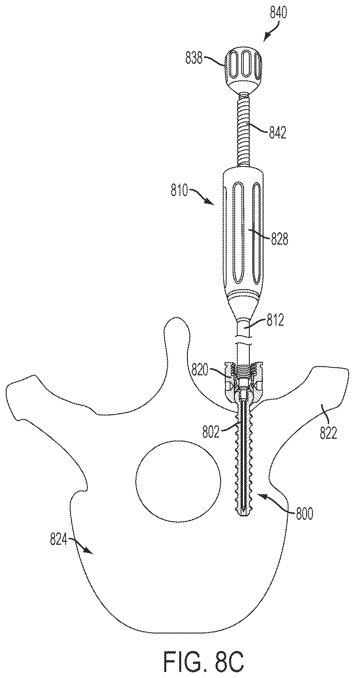 Patent US12551247 Figure 18 – Bone anchors and surgical instruments with integrated guide tips