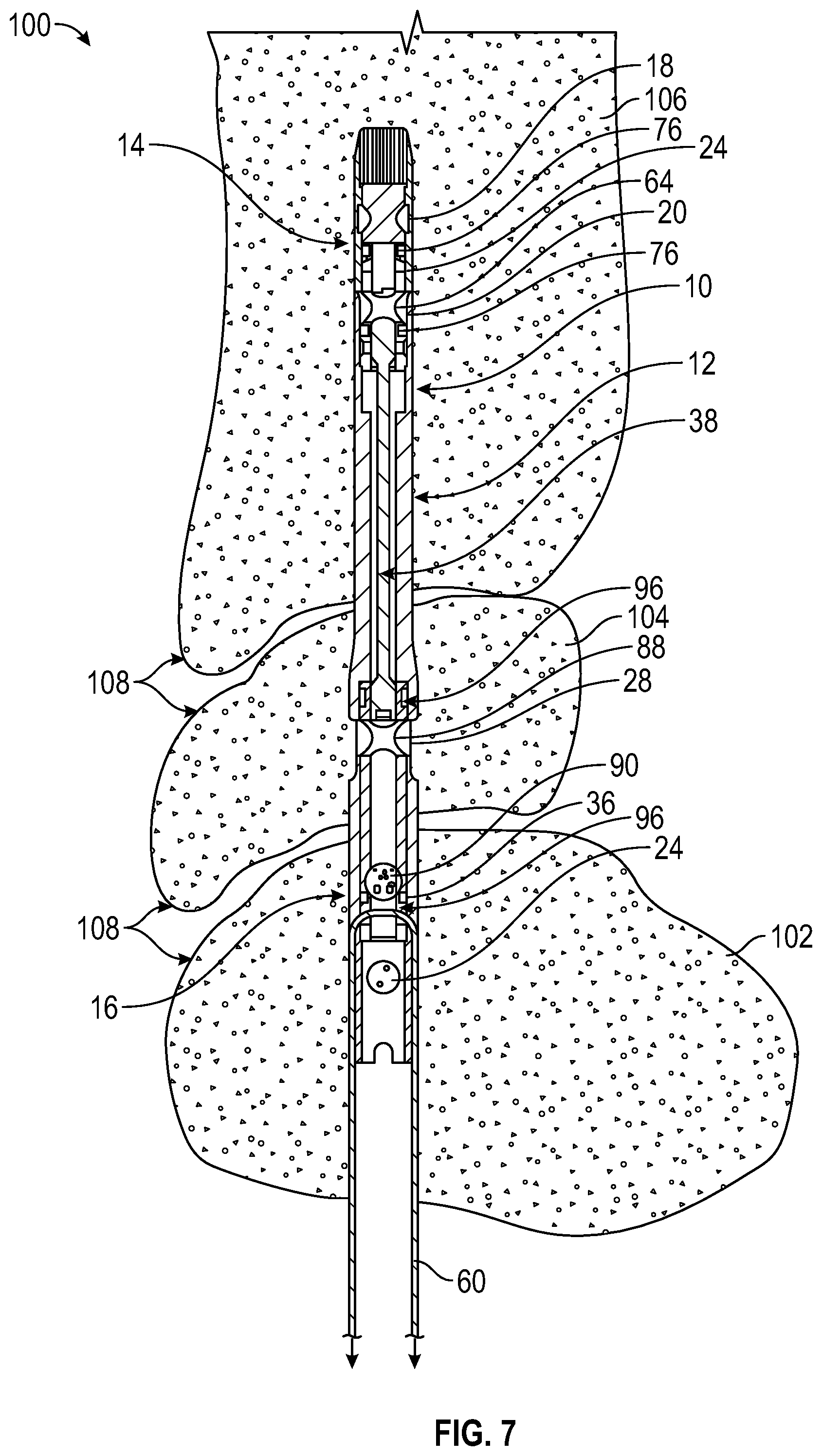 Patent US12551248 Figure 4 – Surgical devices for applying compression within or across joints