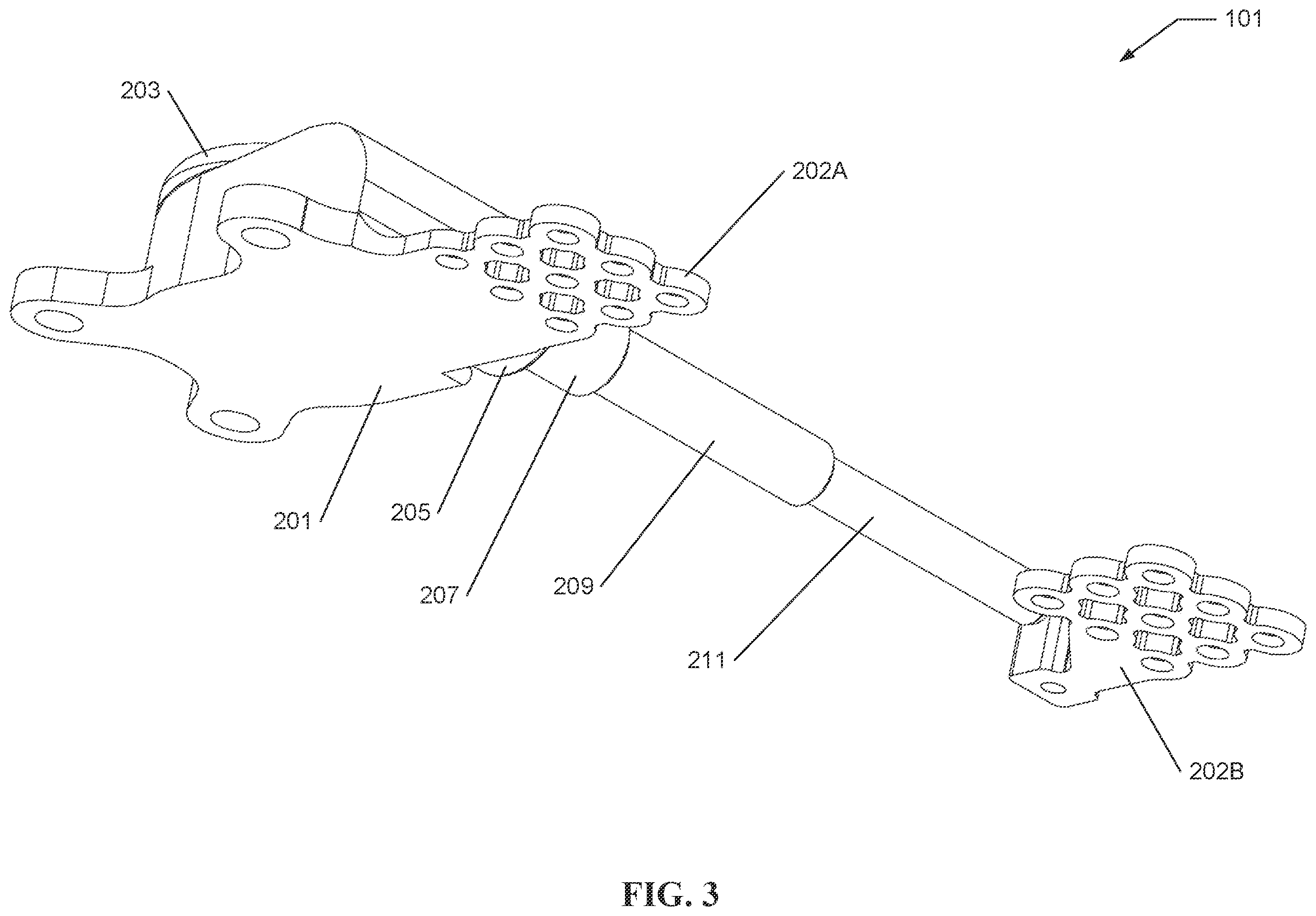 Patent US12551250 Figure 3 – Systems and processes for distraction control