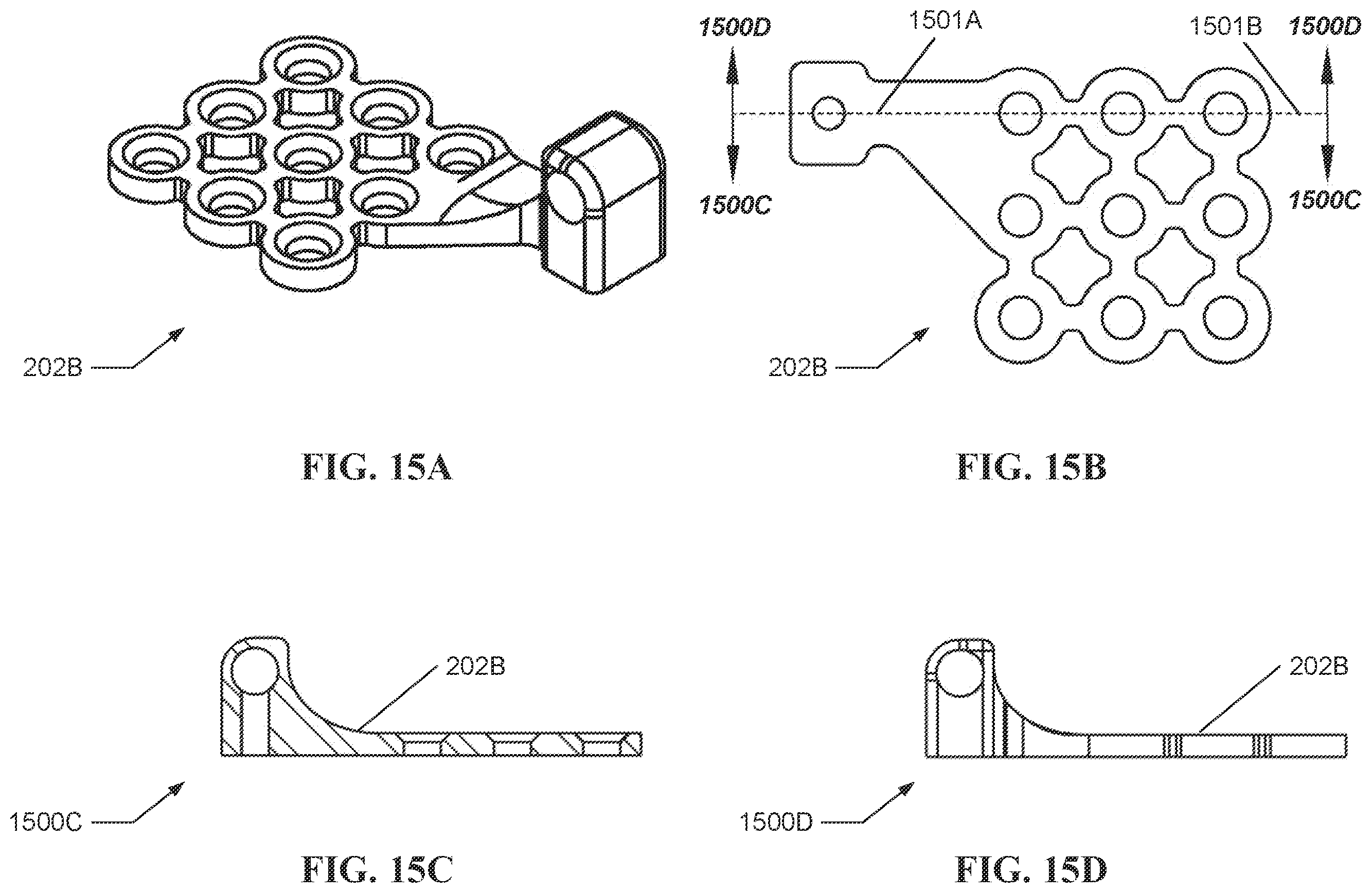 Patent US12551250 Figure 15 – Systems and processes for distraction control