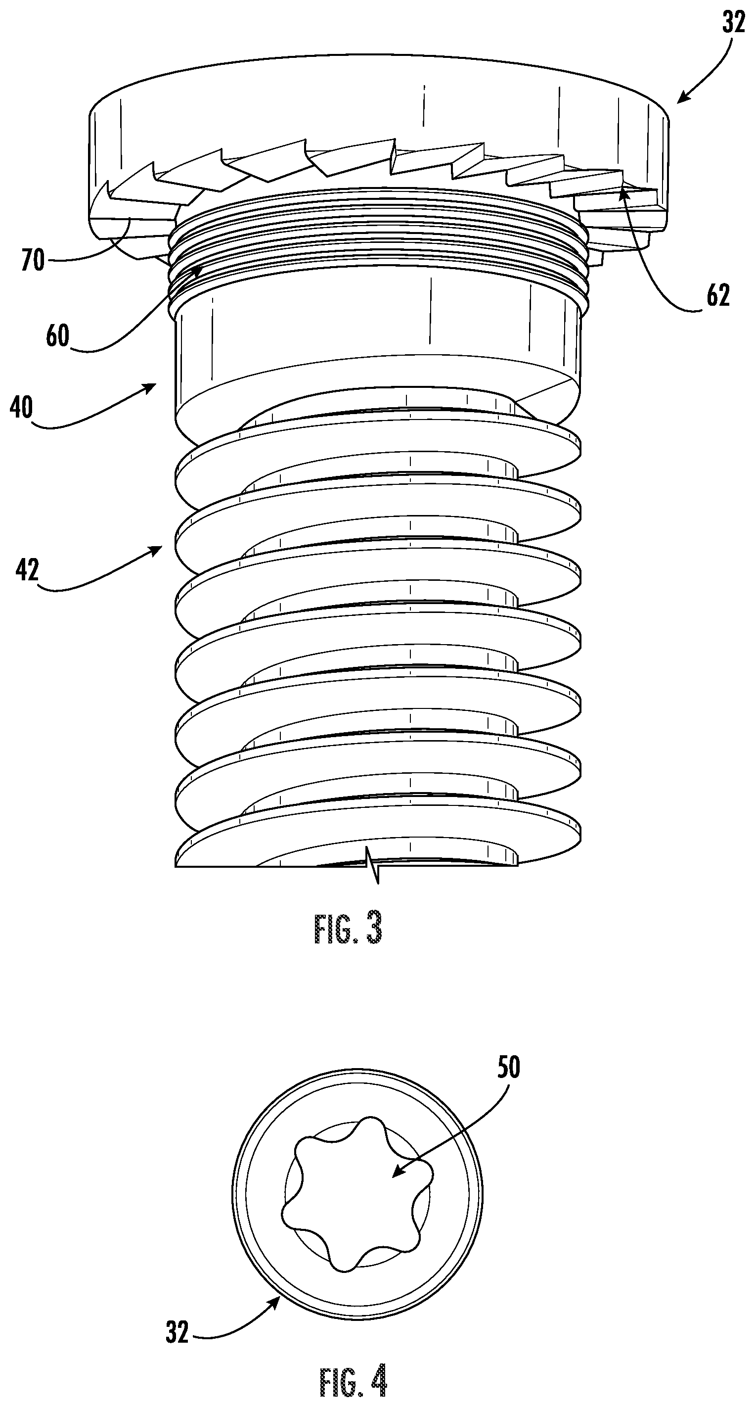 Patent US12551251 Figure 3 – Fixation assemblies for medical implants